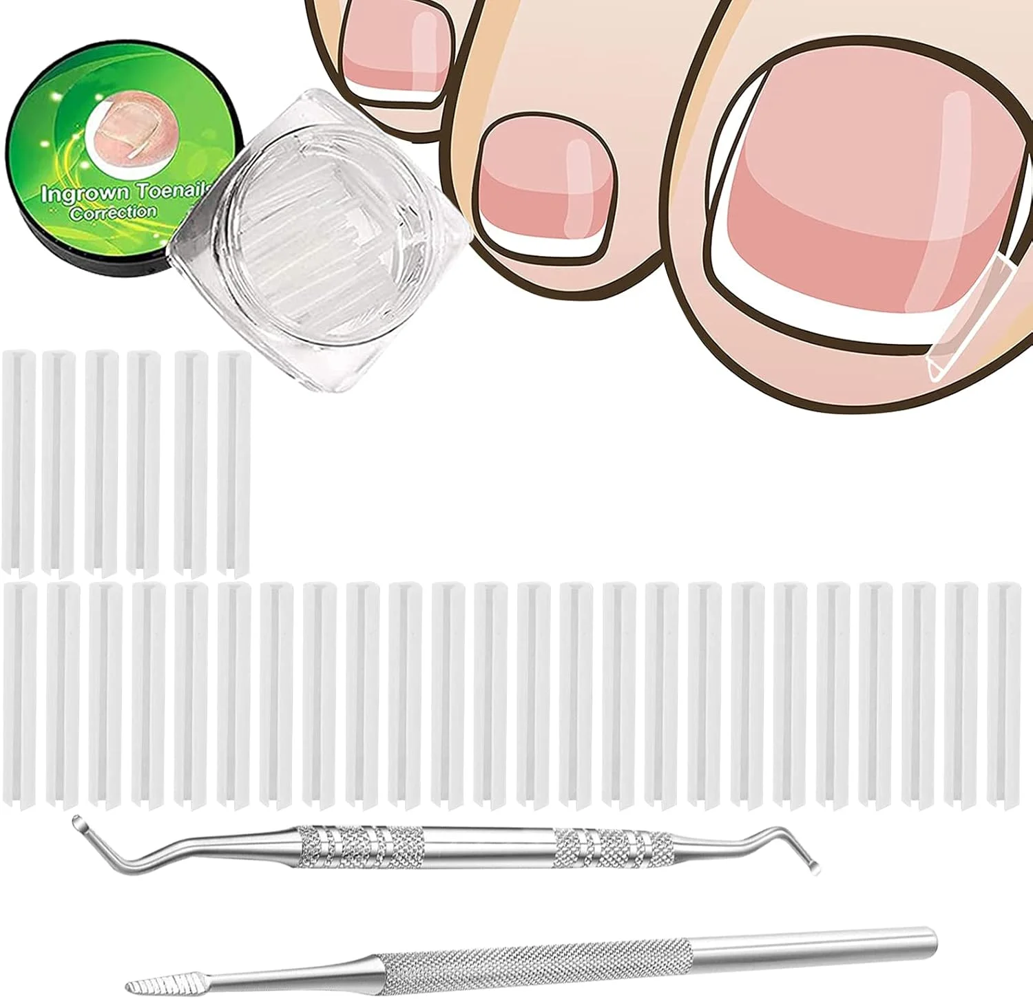 مجموعه (32 عددی) ابزار درمان ناخن فرورفته در گوشت، شامل 30 عدد نوار اصلاح ناخن فرورفته، ابزار پدیکور ناخن فرورفته و 2 عدد ابزار لیفتر و سوهان ناخن فرورفته