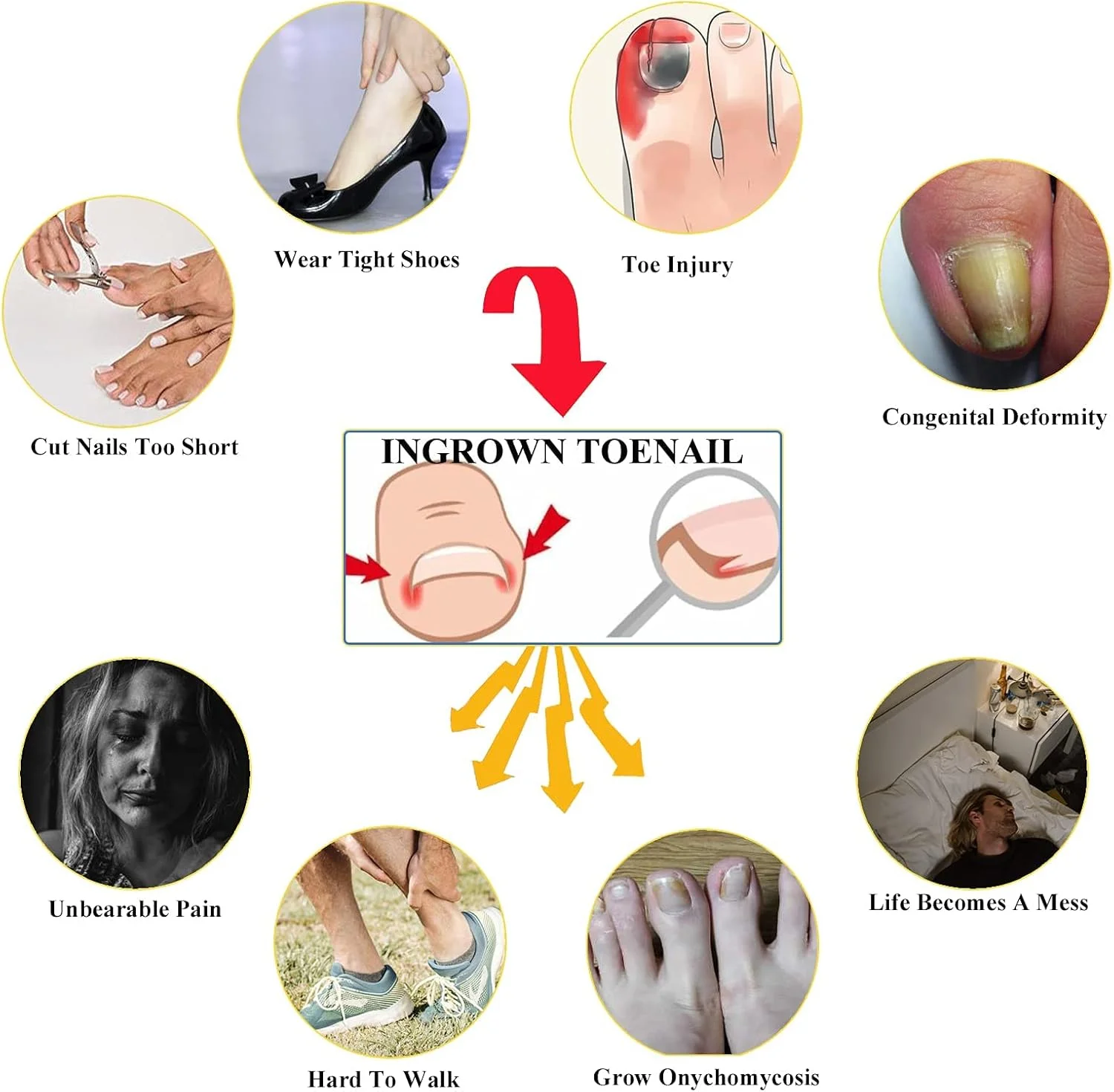 کیت درمان ناخن فرورفته MAKINGTEC با 12 بریس ناخن، لیفتر ناخن فرورفته مسی خالص، ابزار مراقبت از پا فولادی برای پارونیشیا کیت درمان ناخن فرورفته MAKINGTEC با 12 بریس ناخن، لیفتر ناخن فرورفته مسی خالص، ابزار مراقبت از پا فولادی برای پارونیشیا