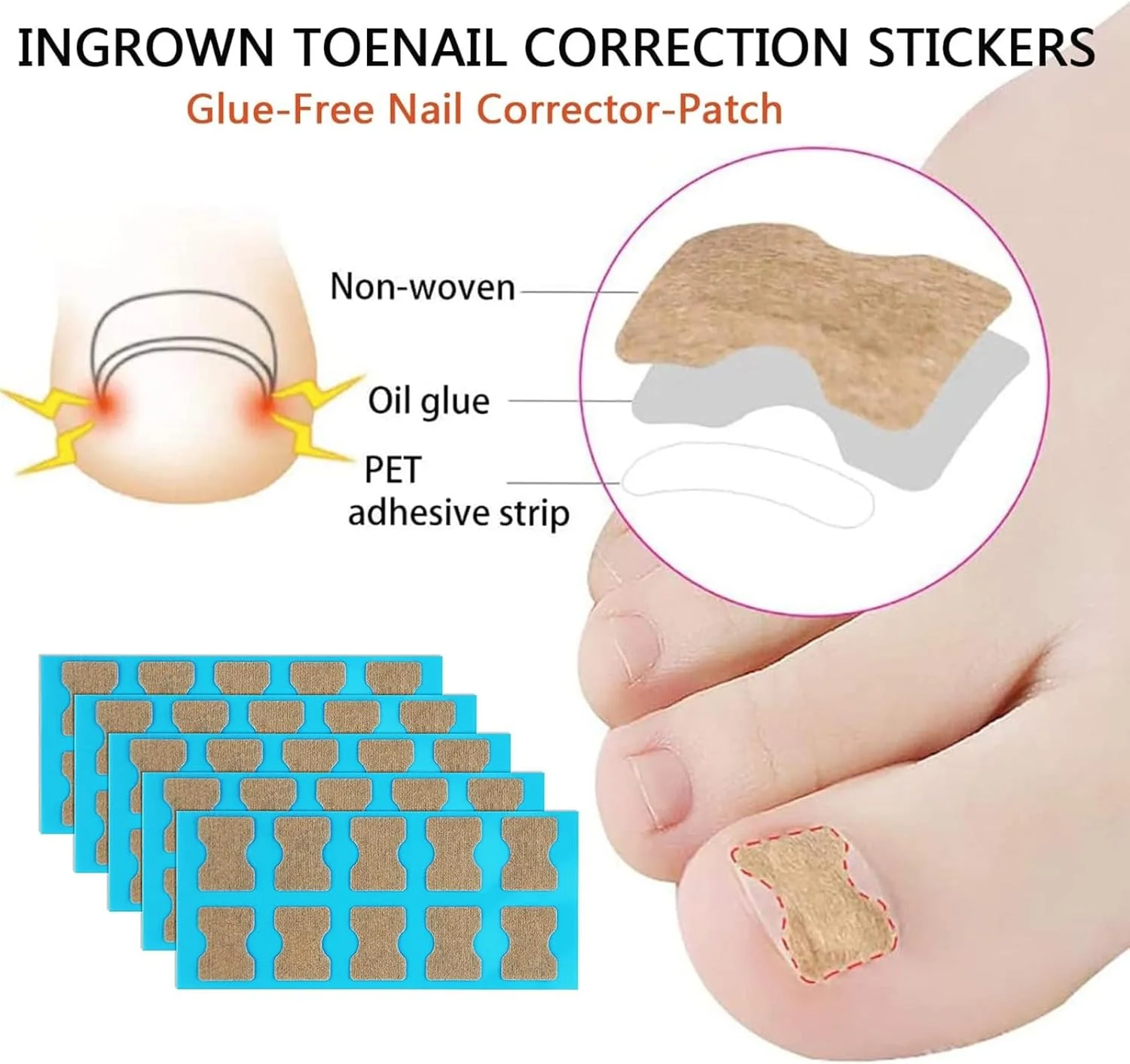 کیت درمان ناخن فرورفته Wisfunlly، نوارهای اصلاح کننده ناخن فرورفته به همراه سوهان و لیفتر، ابزار بدون درد شامل بریس ناخن خمیده و استیکر اصلاح کننده ناخن