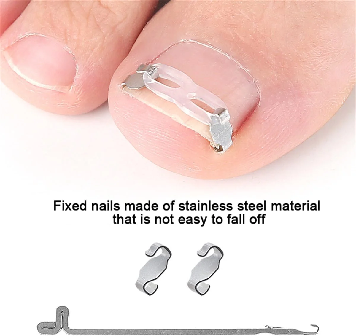 درمان و اصلاح ناخن پا فرورفته، کیت برداشتن ناخن پا فرورفته، صاف کننده ناخن پا خمیده استیل ضد زنگ با نوارهای سیلیکونی، ابزار حرفه ای پدیکور ناخن پا برای ترمیم ناخن خمیده