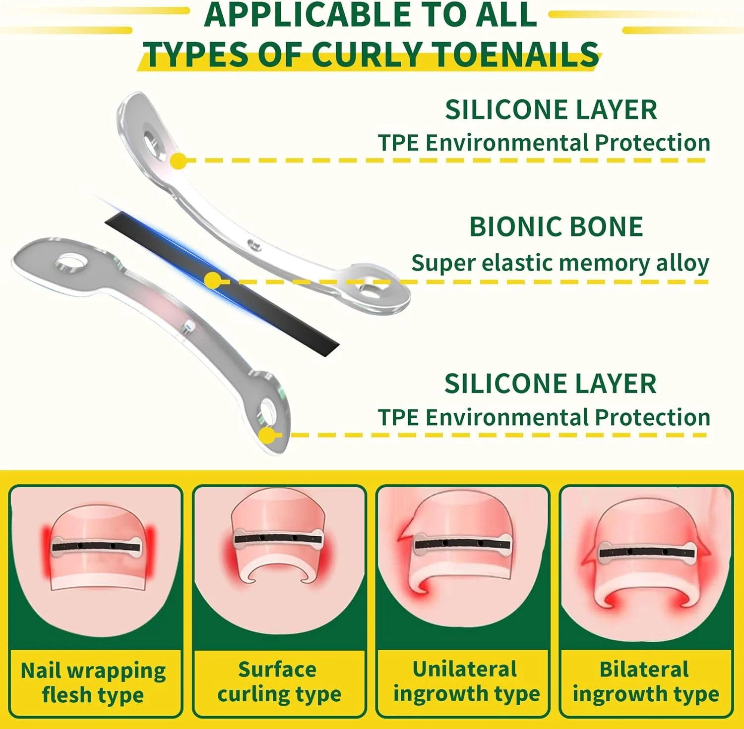 ست درمان و برداشتن ناخن پا فرورفته آلیاژ تیتانیوم سایز بزرگ برای تسکین سریع، ست برداشتن ناخن پا فرورفته، اصلاح کننده حرفه ای ناخن پا فرورفته، ابزار ناخن پا فرورفته برای تسکین سریع، 10 عدد