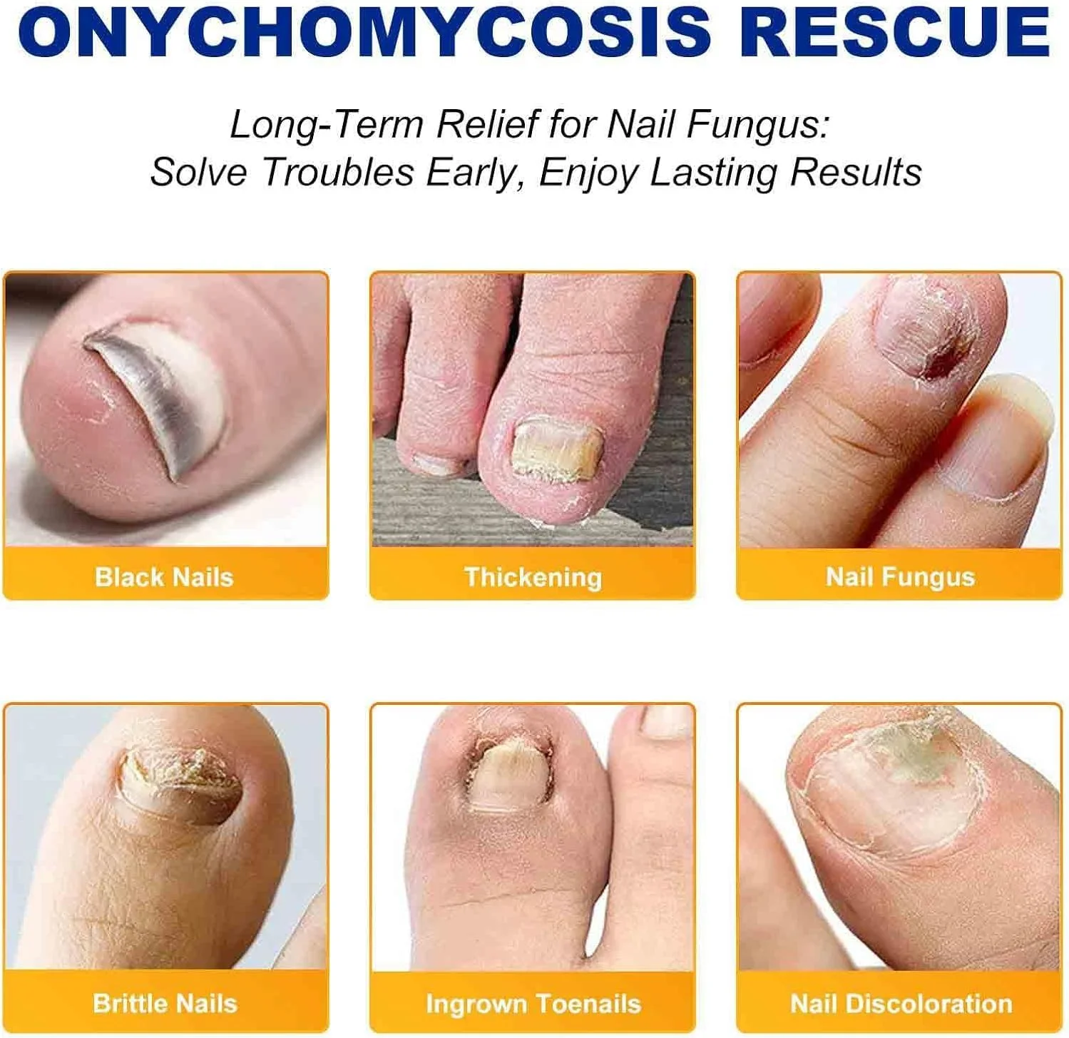 ۴۲ عدد پد درمان قارچ ناخن، پد درمان ناخن پا، ترمیم ناخن برای ناخن های آسیب دیده، بهبود بافت ناخن پا، بازیابی تغییر رنگ و ضخامت، مناسب برای آقایان و بانوان