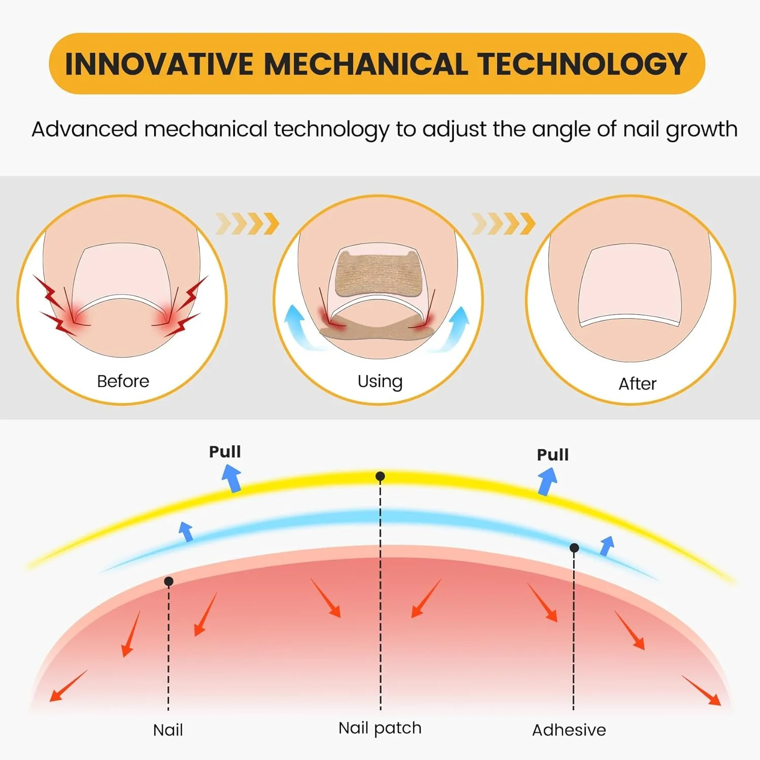 تزویق 60 عدد پد اصلاح ناخن پا فرو رفته قابل تنفس و 50 عدد استیکر ناخن پا فرو رفته، نوار درمان ناخن، ابزار حرفه ای برای ناخن پا فرو رفته، برای تسکین درد و اصلاح