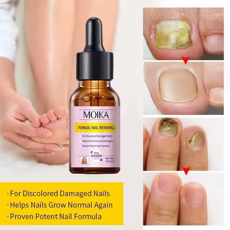 سرم ترمیم کننده ناخن، درمان ناخن های آسیب دیده، تقویت کننده و ترمیم کننده ناخن های شکننده