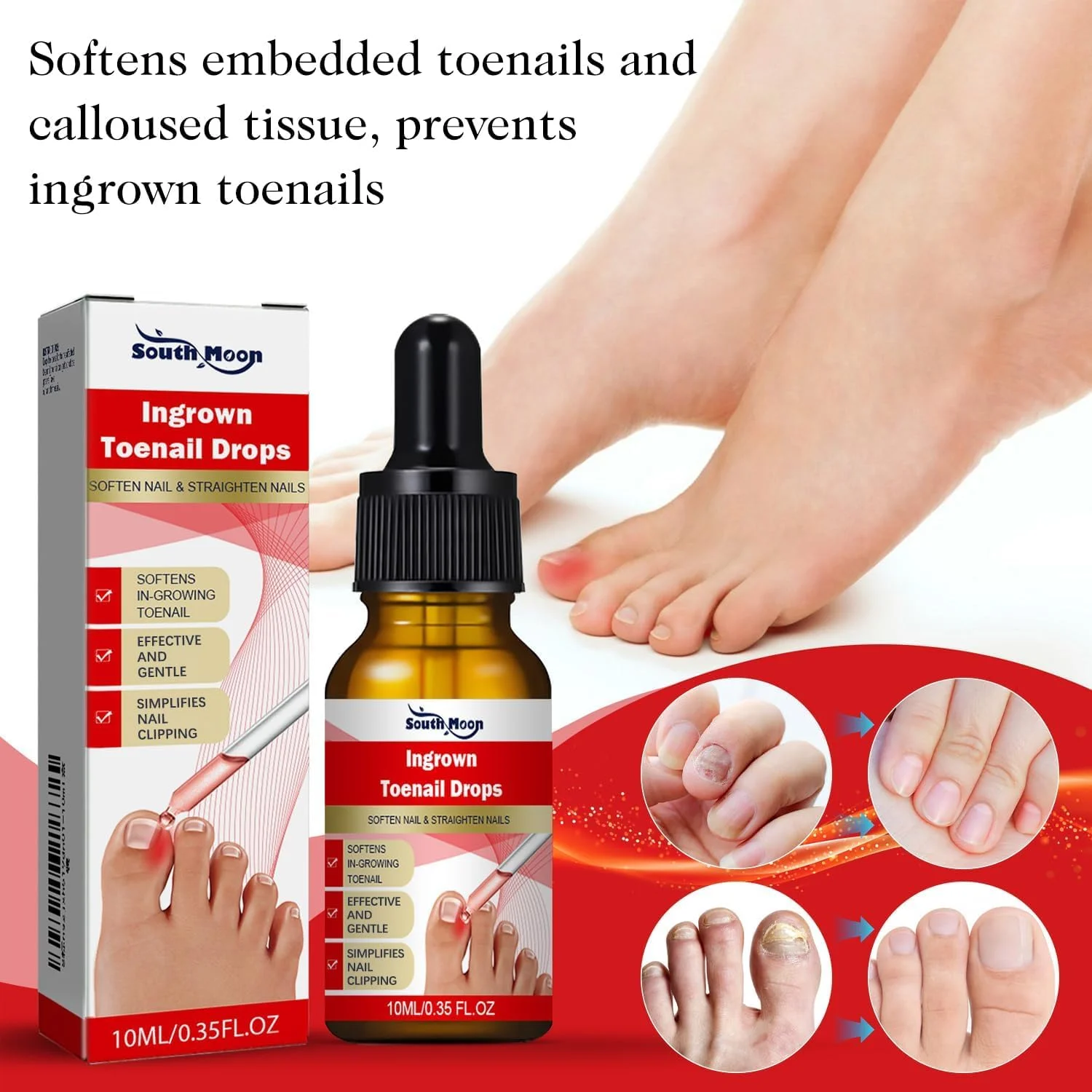 قطره رفع ناخن فرورفته یلا جوی - بسته 2 عددی، مایع تسکین دهنده سریع الاثر ناخن با 10 عدد روکش سیلیکونی انگشت پا، غنی شده با روغن های ضروری برای تسکین درد و نرم کردن، کیت آسان برای اصلاح ناخن فرورفته