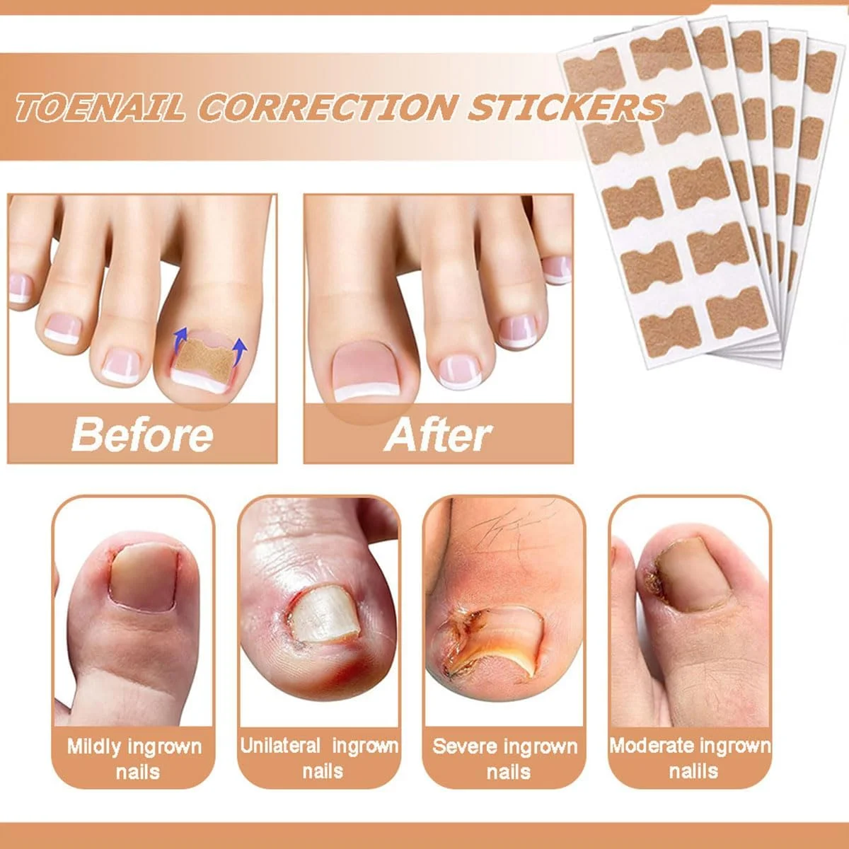 پدهای ترمیم ناخن چند منظوره 50 عددی، درمان ناخن پا برای آسیب های ناشی از قارچ، درمان 8 ساعته برای بازیابی ظاهر سالم