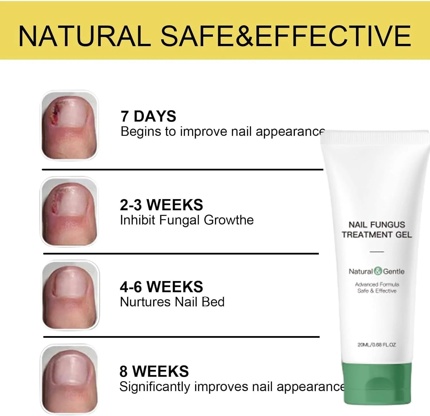 ژل درمان ناخن - کرم ناخن، روغن مراقبت از پا چند منظوره برای ترمیم و تقویت (1)