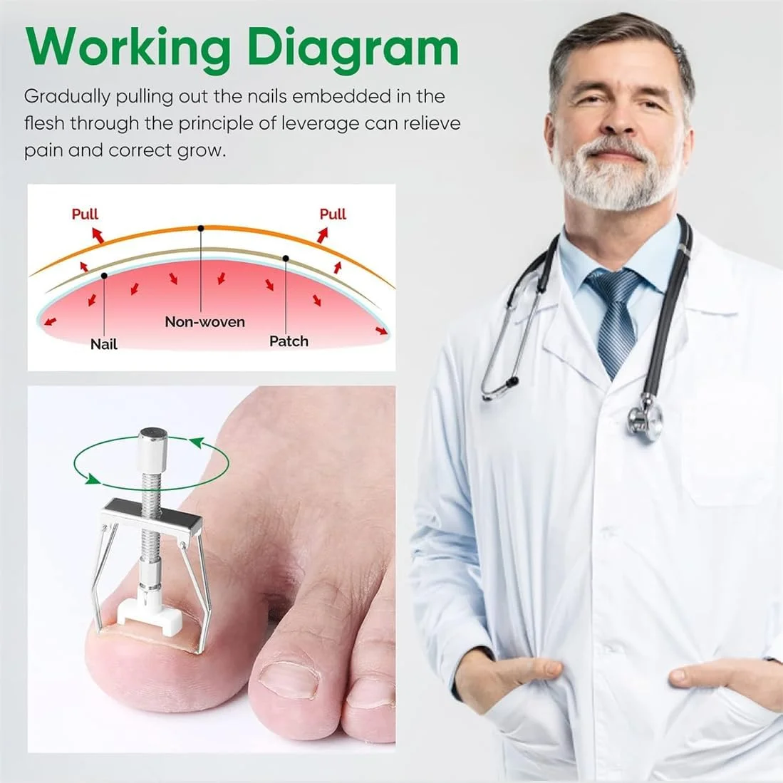 کیت درمان ناخن فرورفته در گوشت، تسکین موثر درد ناخن، شامل اصلاح کننده ناخن فرورفته، نوارهای اصلاحی، نگهدارنده های پدیکور ناخن، موچین و پدهای اصلاح ناخن