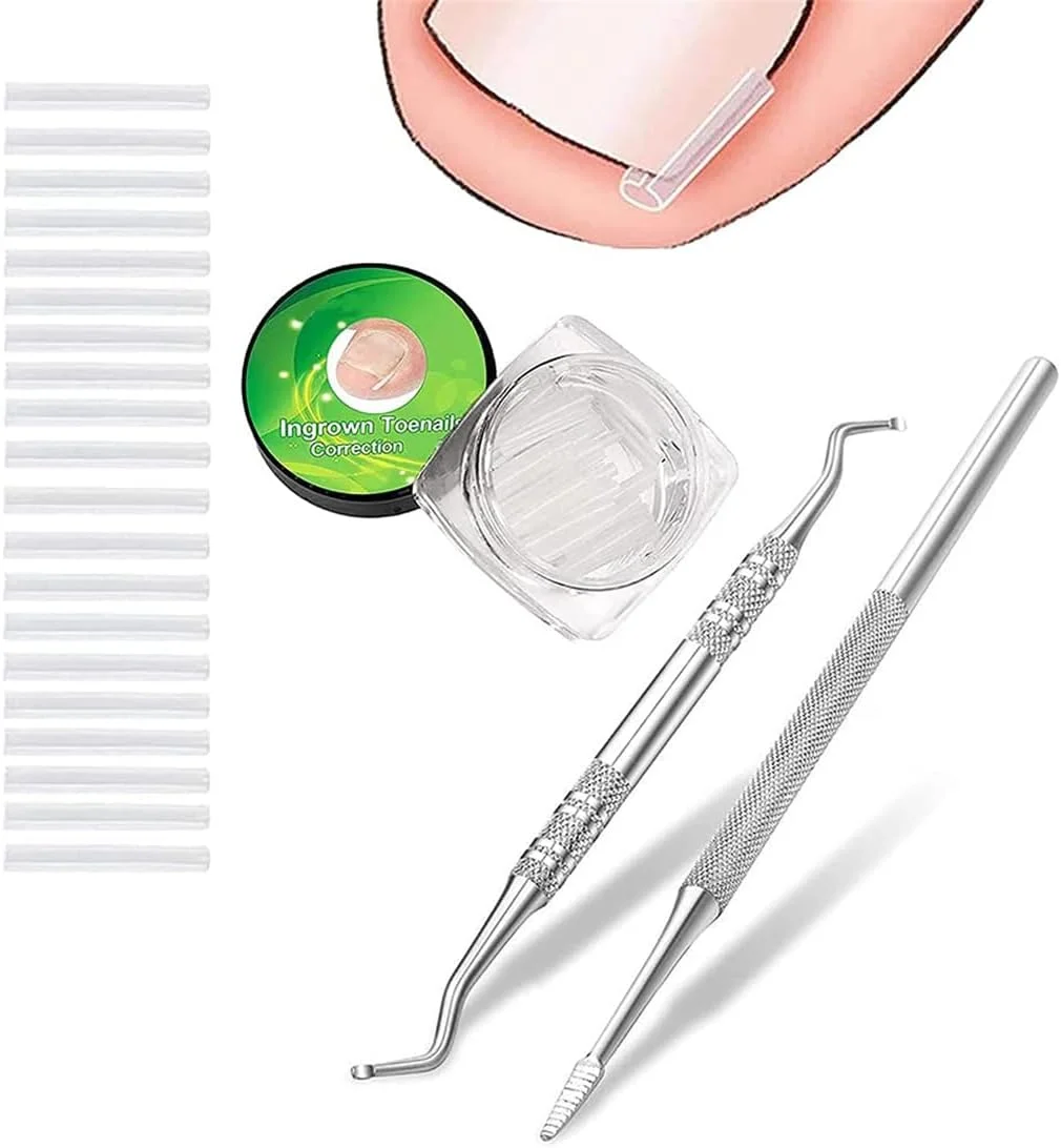 کیت درمان حرفه ای ناخن فرورفته، 50 عدد نوار صاف کننده و اصلاح کننده ناخن فرورفته همراه با 2 عدد سوهان و لیفتر ناخن فرورفته برای بهبود ناخن های خمیده کیت درمان حرفه ای ناخن فرورفته، 50 عدد نوار صاف کننده و اصلاح کننده ناخن فرورفته همراه با 2 عدد سوهان و لیفتر ناخن فرورفته برای بهبود ناخن های خمیده