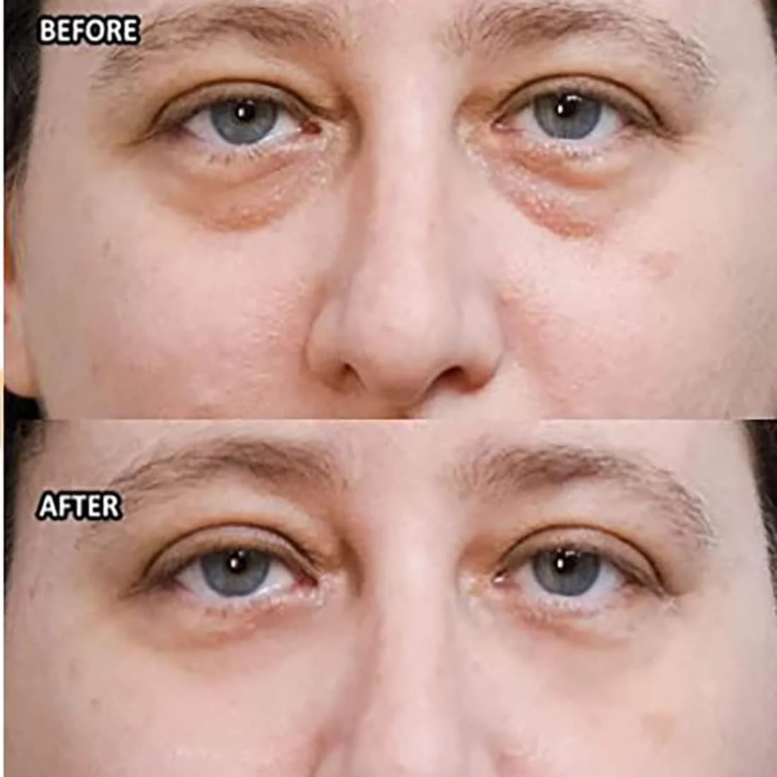 کرم فوری زیر چشم Wow-IT، کرم ضد چروک چشم، کمک به کاهش فوری پف زیر چشم (3 عدد)