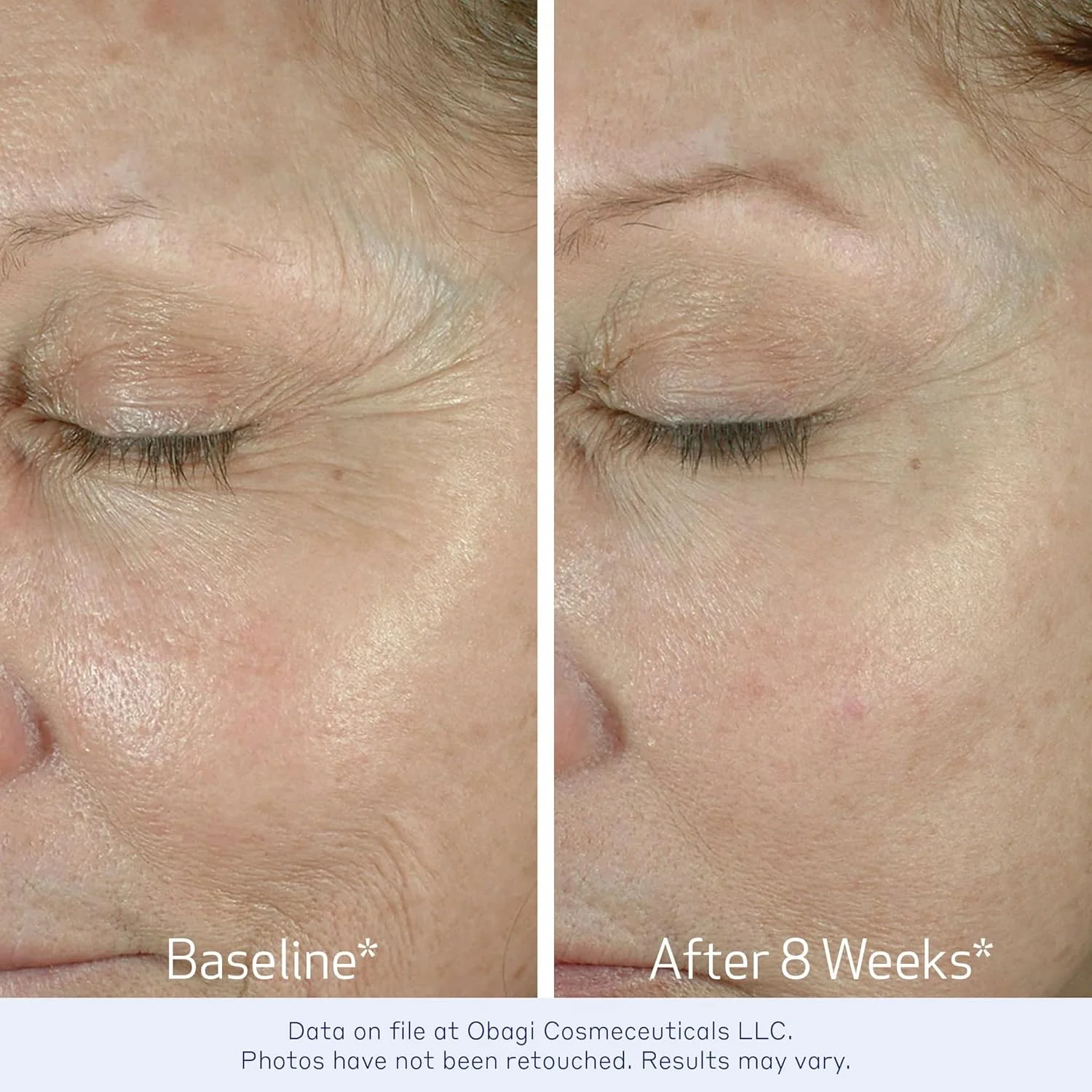 کرم دور چشم اوباجی مدیکال الاستیدرم، کرم سفت کننده دور چشم برای خطوط ریز و چروک، تست شده توسط چشم پزشک، بسته 15 گرمی