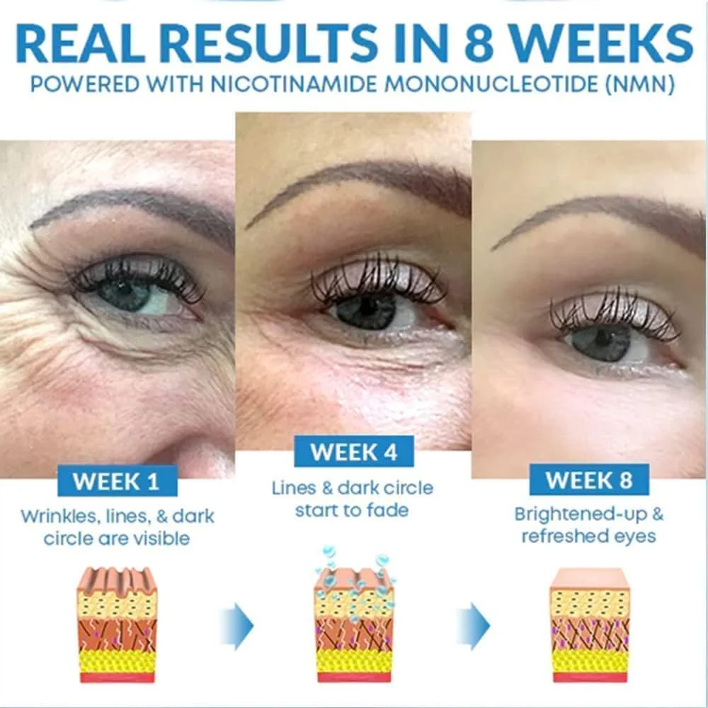 کرم دور چشم Hyakuon Youthrestore Nmn، کرم سفت کننده و رفع کننده پف دور چشم Hyakuon، کرم ضد چروک دور چشم برای سیاهی و پف زیر چشم، مناسب برای انواع پوست (1 عدد)