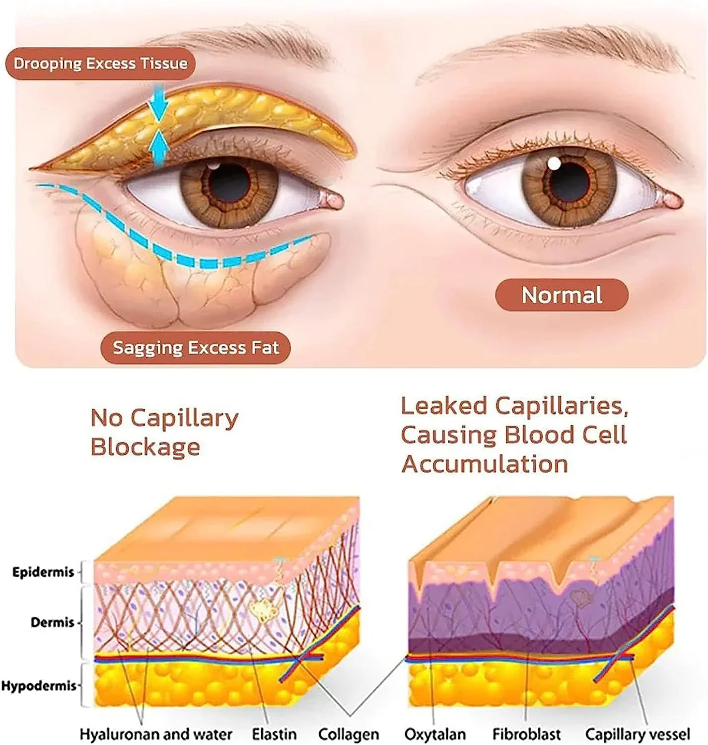 کرم دور چشم حاوی اسانس خاویار Peehss، کرم دور چشم مرطوب کننده و الاستیک Dsiuan، کرم دور چشم کلاژن ضد پیری، کرم ترمیم کننده دور چشم برای سیاهی و پف (3 عدد) کرم دور چشم حاوی اسانس خاویار Peehss، کرم دور چشم مرطوب کننده و الاستیک Dsiuan، کرم دور چشم کلاژن ضد پیری، کرم ترمیم کننده دور چشم برای سیاهی و پف (3 عدد)