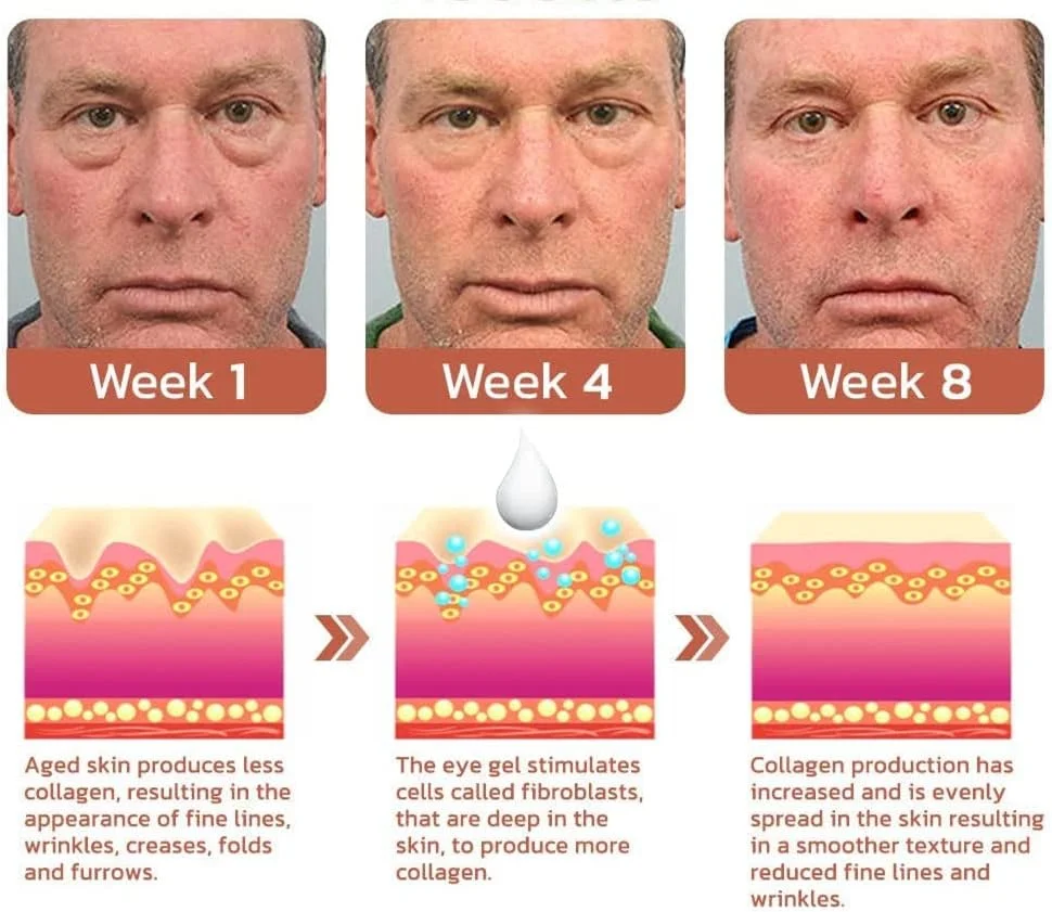 ژل دور چشم پپتیدی Axoeye Renew، کرم دور چشم ضد چروک، کرم دور چشم جادویی برای رفع پف زیر چشم، کرم دور چشم ضد پیری برای پف زیر چشم، چروک، خطوط ریز، سیاهی دور چشم (2 عدد)