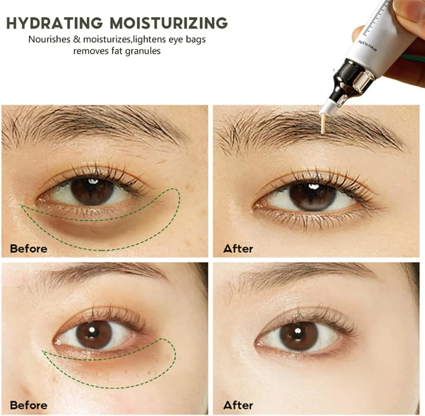 ژل دور چشم پپتیدی Axoeye Renew، کرم دور چشم ضد چروک، کرم دور چشم جادویی برای رفع پف زیر چشم، کرم دور چشم ضد پیری برای پف زیر چشم، چروک، خطوط ریز، سیاهی دور چشم (2 عدد)