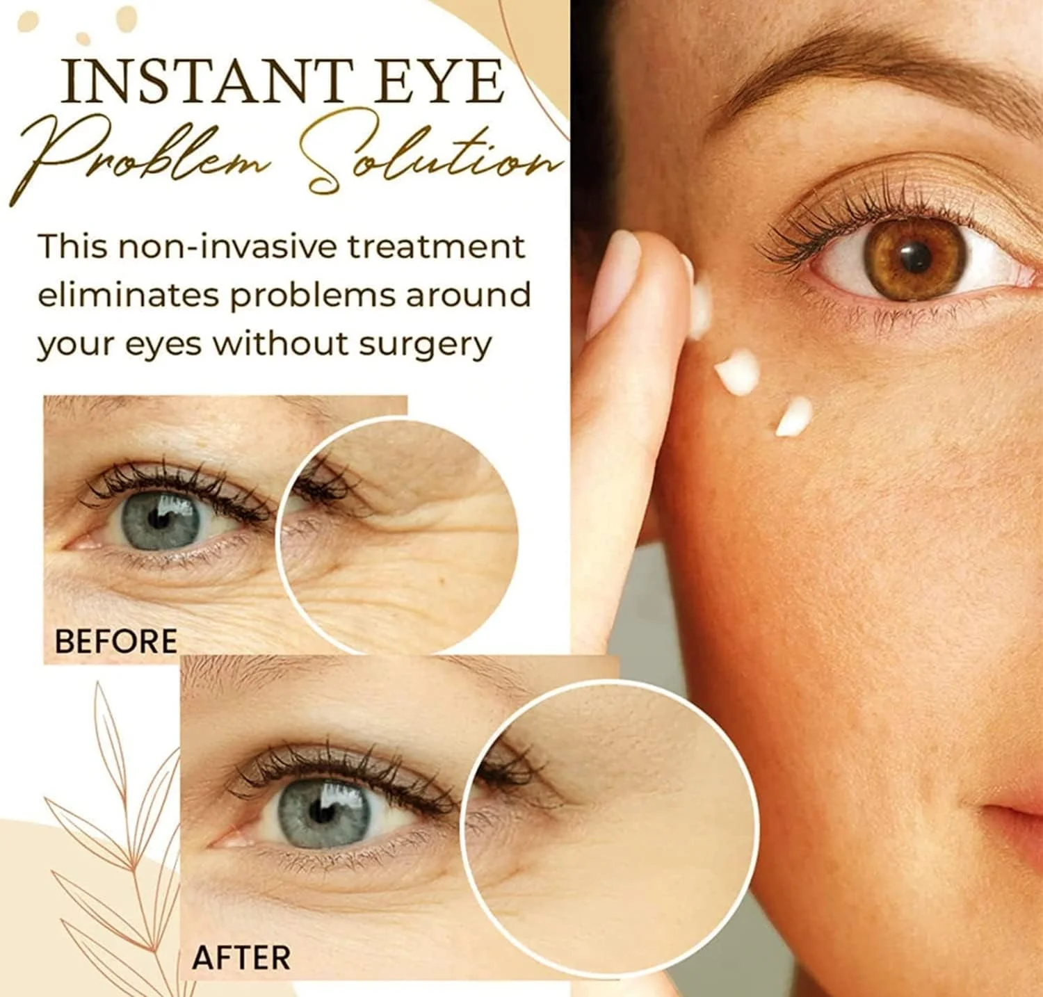 کرم دور چشم عصاره برنج 2022، کرم دور چشم ضد چروک عصاره برنج، سرم طبیعی برنج برای چروک زیر چشم، کرم دور چشم برای چروک، تیرگی، پف و سیاهی دور چشم (1 عدد)