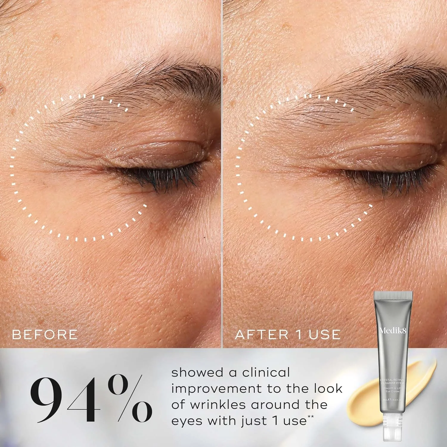 کرم دور چشم سرامید 3 رتینال مدیک8 - ضد پیری و ضد چروک - کرم صاف کننده و لیفت کننده دور چشم - قدرت رتینال 0.03% - 11 برابر سریعتر از رتینول - برای مصرف کنندگان جدید ویتامین A - 15 میلی لیتر