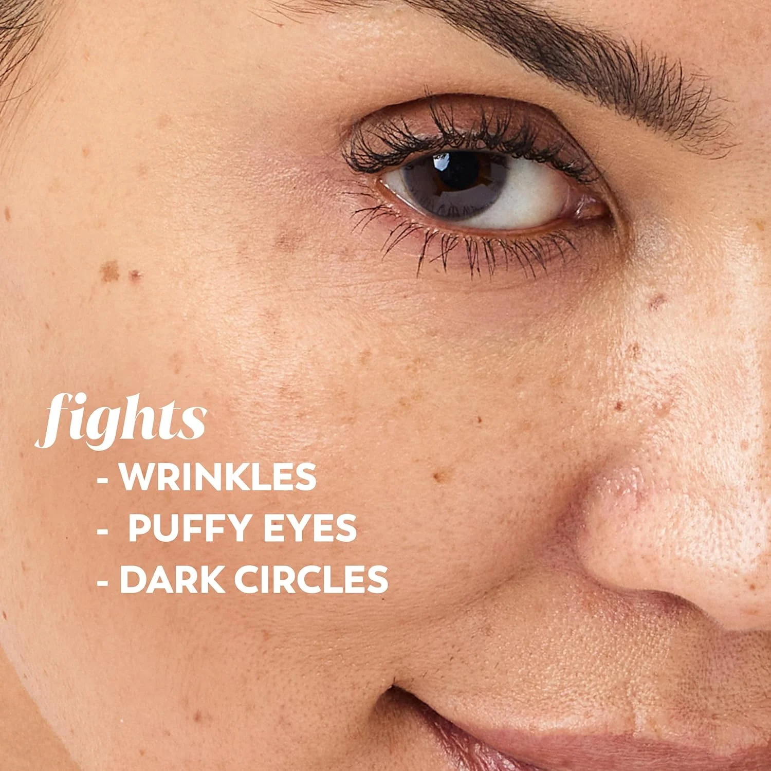 کرم دور چشم اولای آلتیمیت