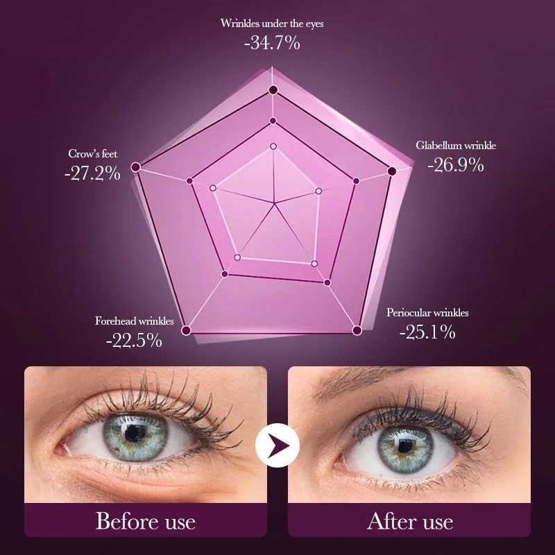 کرم دور چشم ضد چروک برنج سفید و رز، 8 بعدی، 20 گرم – کرم دور چشم پیشرفته حاوی موسین حلزون و نیاسینامید برای تیرگی، پف و خطوط ریز | سفت کننده، روشن کننده و مراقبت از چشم