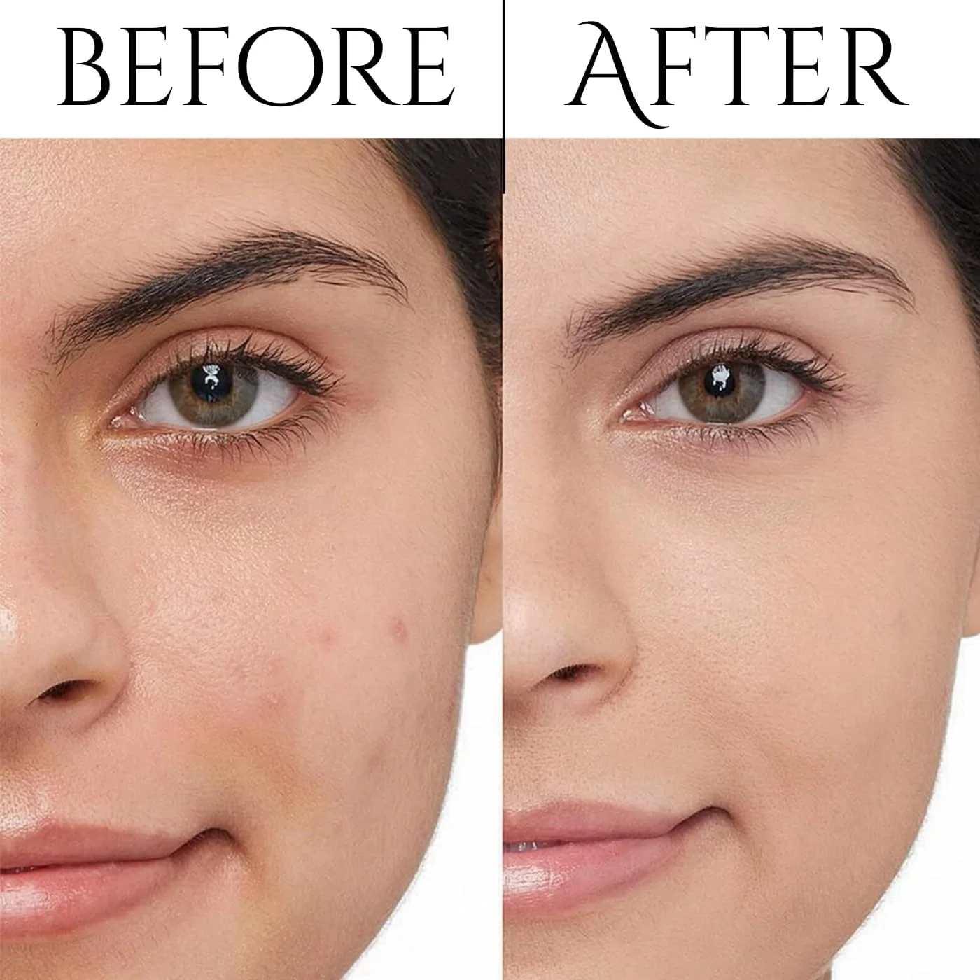 سرم ویتامین C 15% برای صورت - ضد پیری، آبرسان و اصلاح کننده لک های تیره - حاوی اسید هیالورونیک و آنتی اکسیدان های فرولیک اسید - مناسب برای خانم ها و آقایان