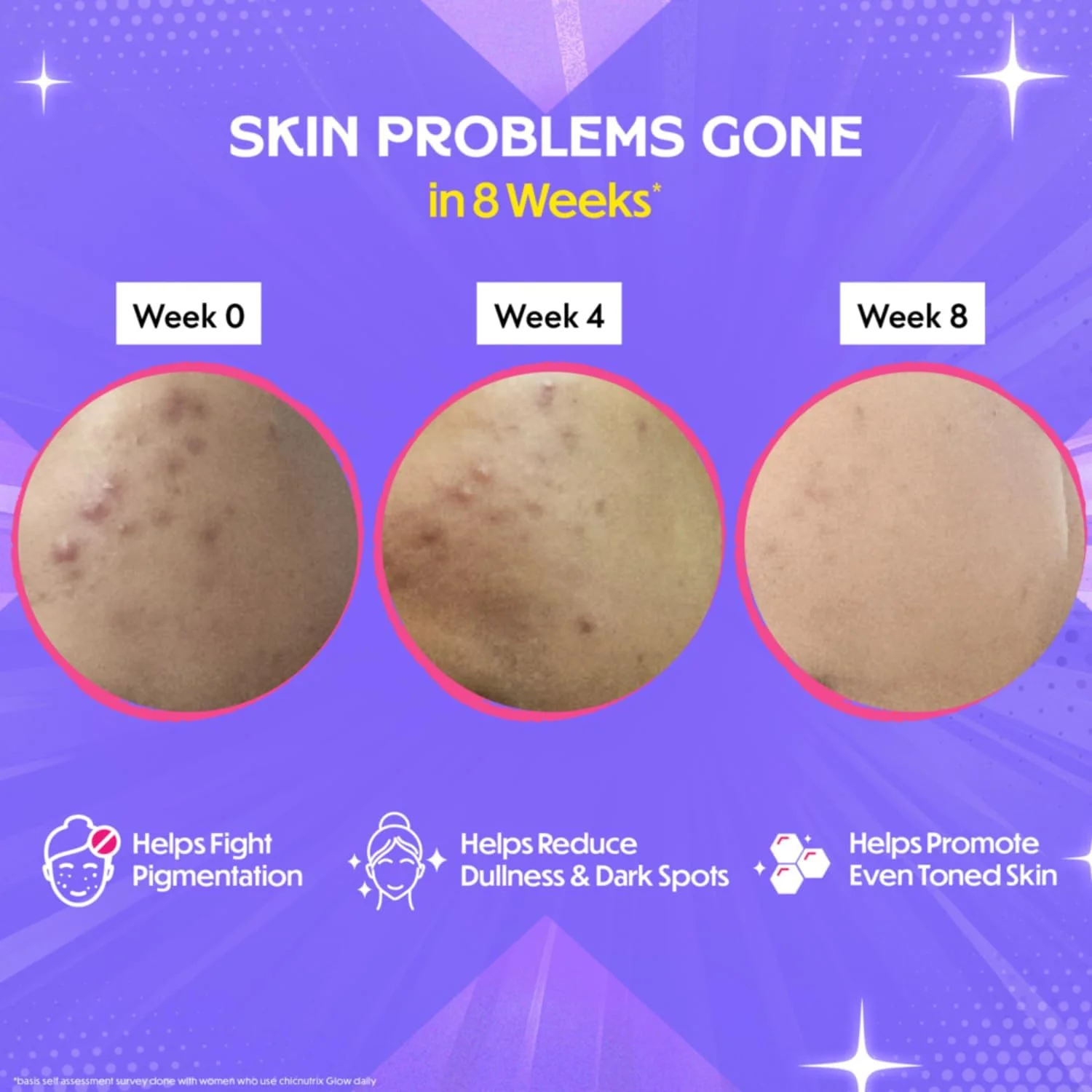 قرص جوشان گلوتاتیون Chicnutrix Glow با ویتامین C | گلوتاتیون ژاپنی 500 میلی گرم برای پوست درخشان، یکدست و براق | بدون شکر | طعم توت فرنگی لیمو، 20 عدد (بسته 2 عددی)