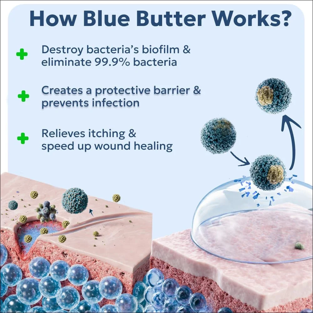 کرم مراقبت از زخم بلو باتر فورتیسپت برای سگ و اسب، پماد درمان نقاط داغ، ژل ضد میکروبی پوست 113 گرم کرم مراقبت از زخم بلو باتر فورتیسپت برای سگ و اسب، پماد درمان نقاط داغ، ژل ضد میکروبی پوست 113 گرم