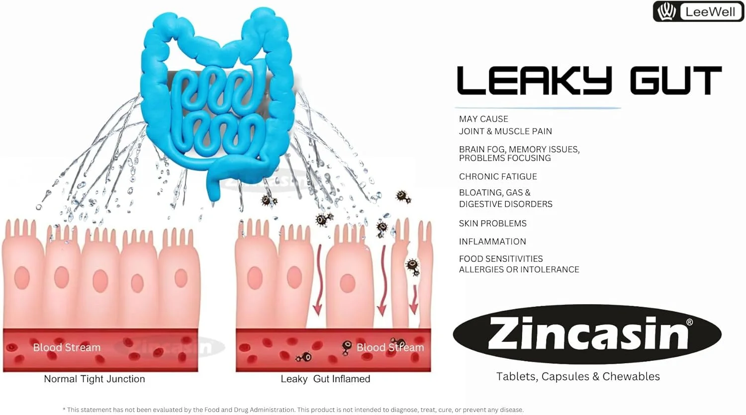 زینکاسین با کمپلکس زینک ال کارنوزین 75 میلی گرم | پشتیبانی از دستگاه گوارش و مکمل سلامت روده | کمک به محافظت از پوشش معده - 90 قرص گیاهی زینکاسین با کمپلکس زینک ال کارنوزین 75 میلی گرم | پشتیبانی از دستگاه گوارش و مکمل سلامت روده | کمک به محافظت از پوشش معده - 90 قرص گیاهی