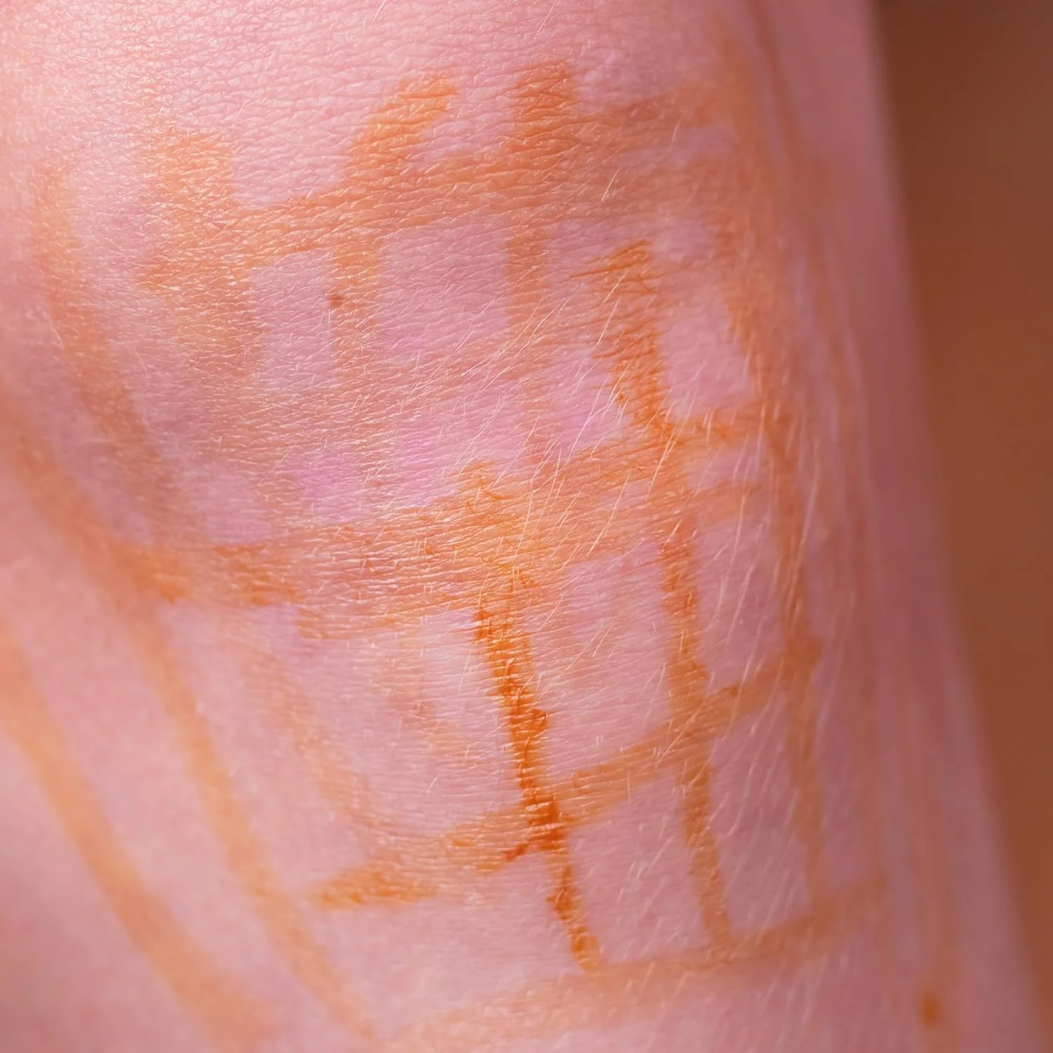 محلول لوگول - محلول لوگول ید - 30 میلی لیتر - 5% - 2% - قطره ید با دوز بالا - بدون الکل - قطره ید - محلول ید (2%) محلول لوگول - محلول لوگول ید - 30 میلی لیتر - 5% - 2% - قطره ید با دوز بالا - بدون الکل - قطره ید - محلول ید (2%)