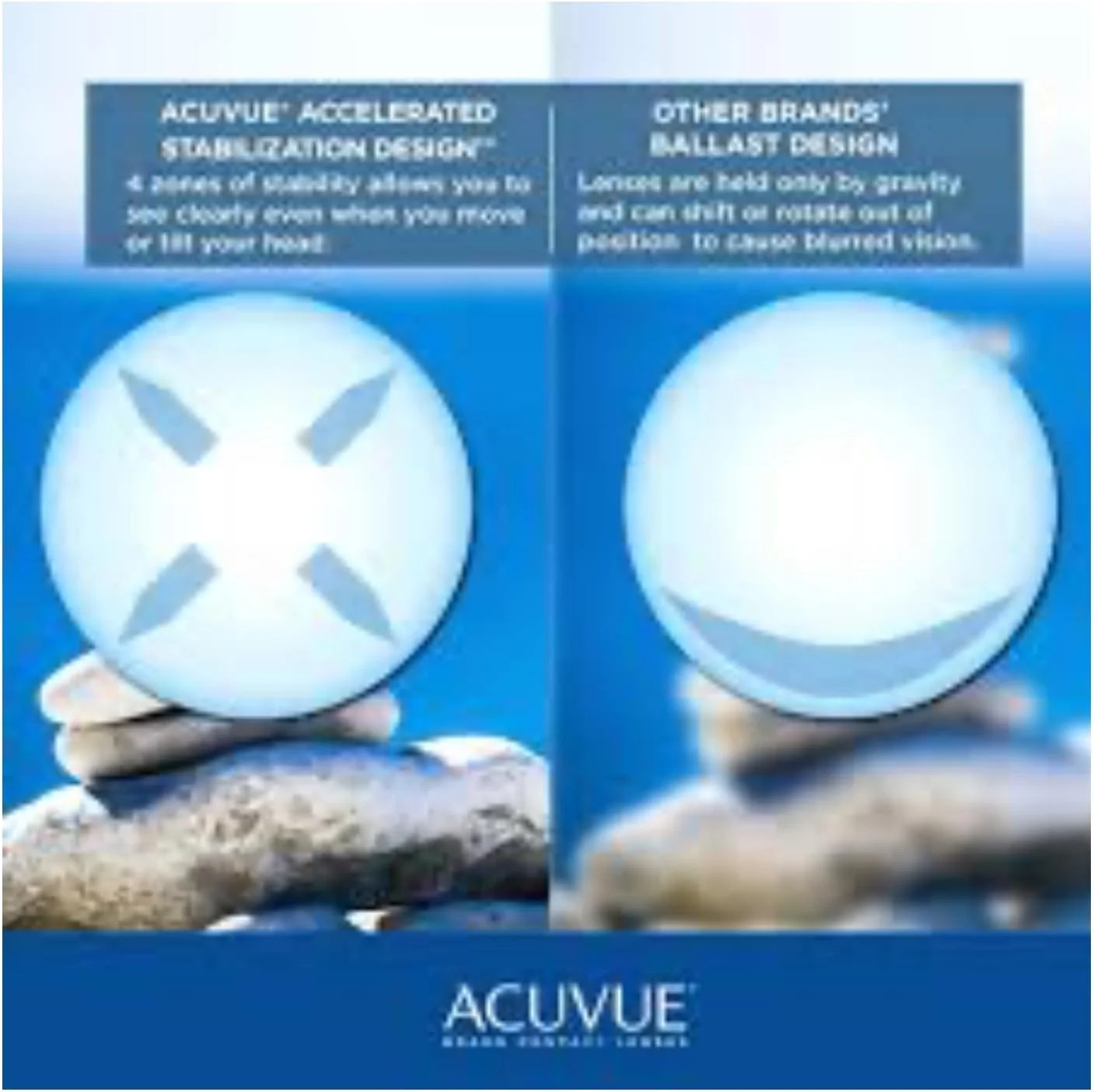 لنزهای تماسی روزانه آکیو ویو 1-Day Moist - توان های مختلف - J&J (30 لنز در بسته) (-4.75, 8.5, 14.2, 30) لنزهای تماسی روزانه آکیو ویو 1-Day Moist - توان های مختلف - J&J (30 لنز در بسته) (-4.75, 8.5, 14.2, 30)