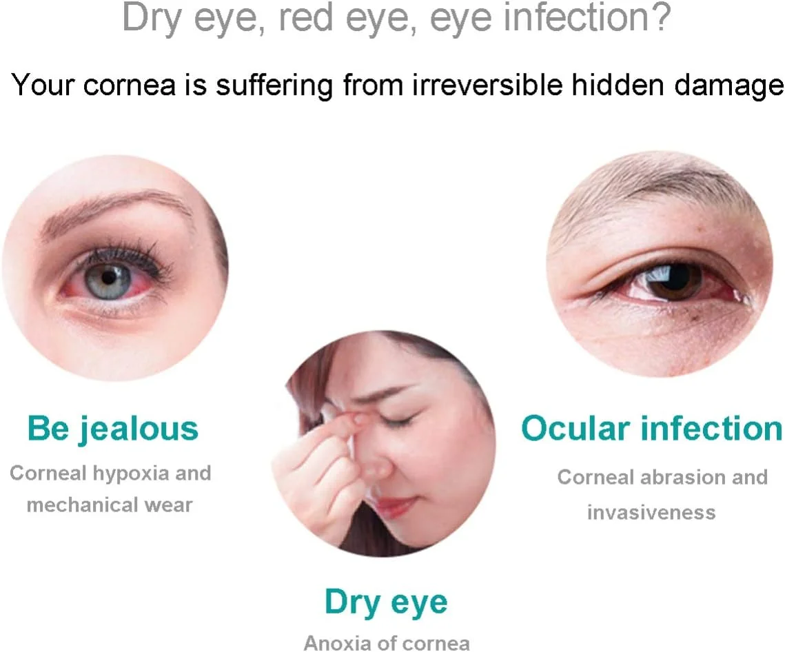 جعبه نگهداری لنز تماسی طرح گل، جا لنزی طرح گل، ظرف لنز تماسی مناسب مسافرت - 2 عدد