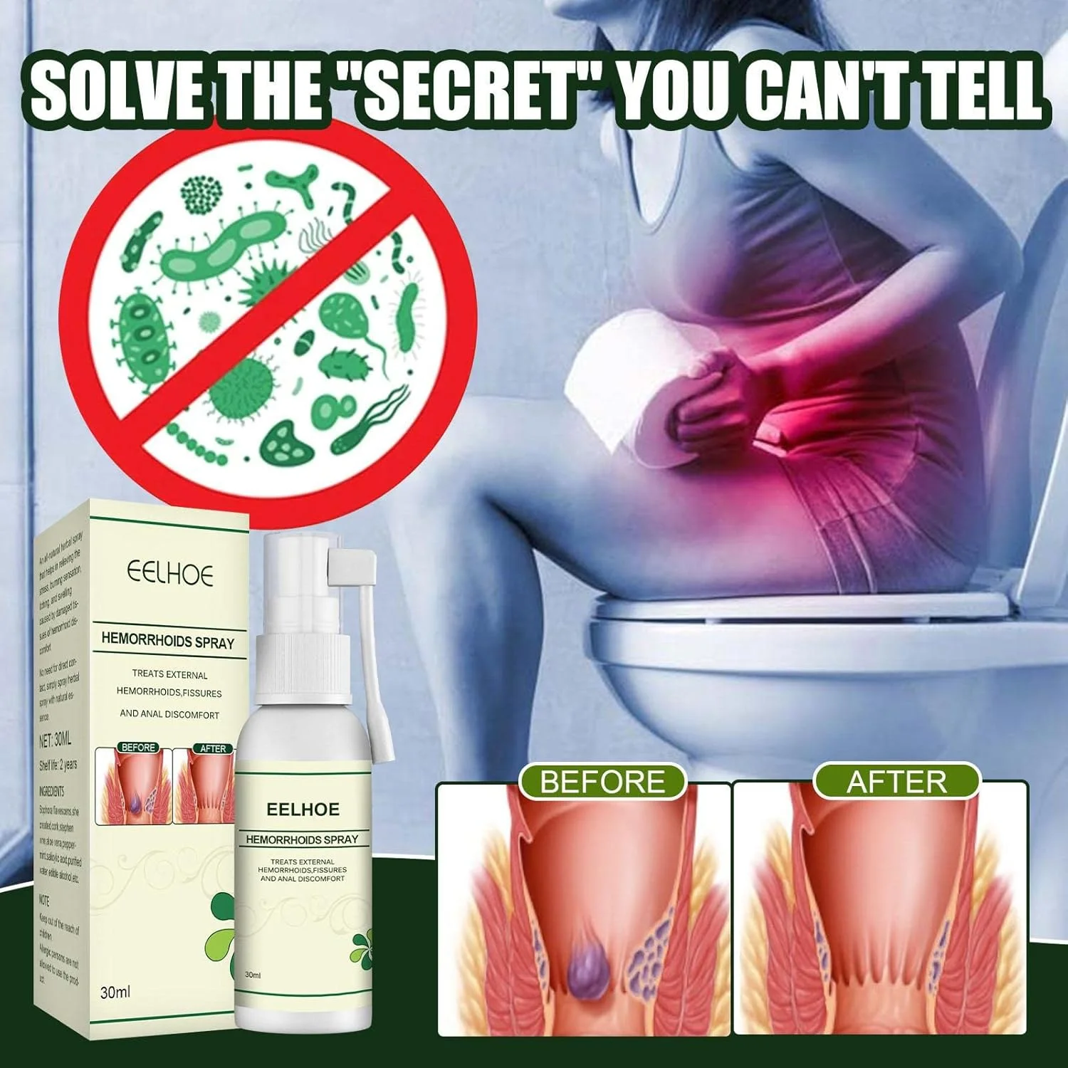 اسپری هموروئید 30 میلی لیتر، قوی و ملایم برای تسکین خارش و درد، مناسب برای بانوان و آقایان