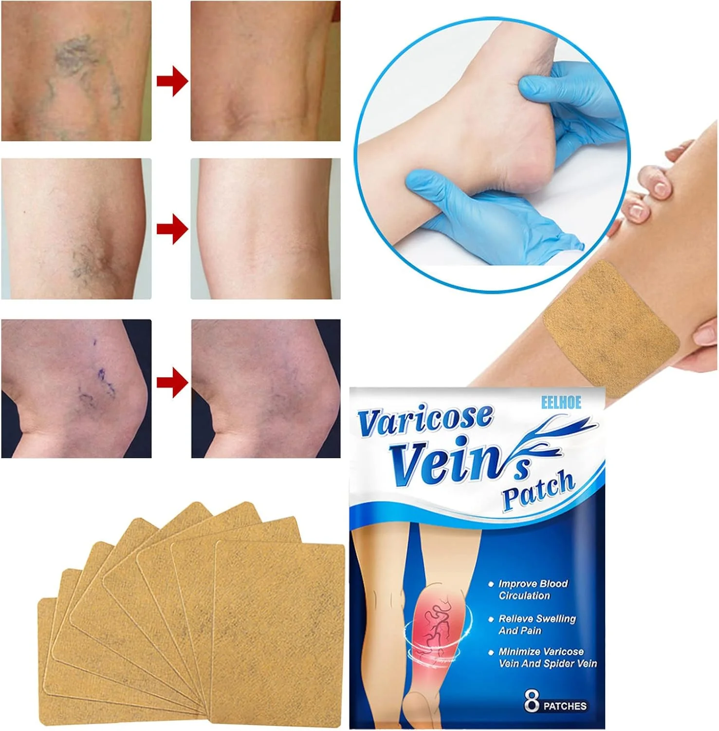 پد بهبود سلامت وریدها، پد گیاهی کرم وریدهای واریسی، تسکین درد پا، رگ های عنکبوتی، واسکولیت، بهبود گردش خون و متابولیسم (آبی، 16 * 12 * 2 سانتی متر)