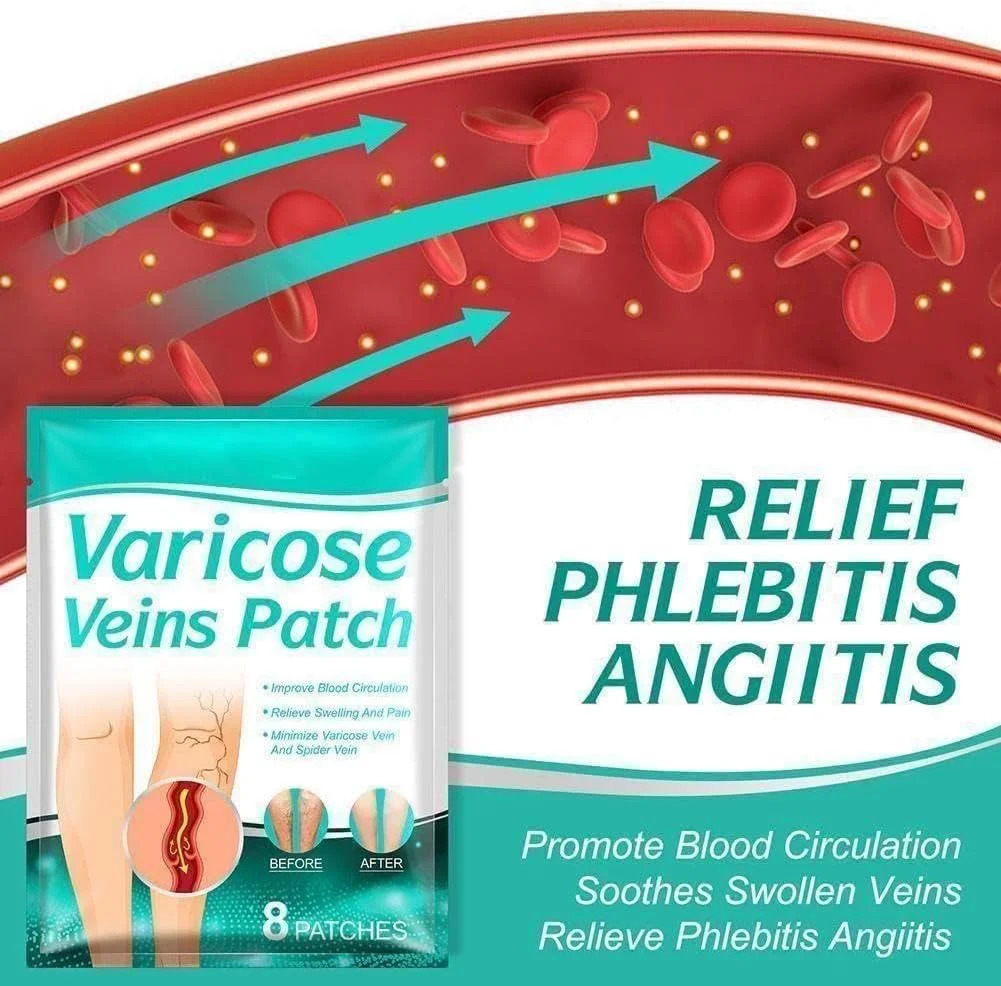 پد درمان رگ های واریسی، تسکین التهاب عروق، فلبیت، تصلب شرایین، خستگی اندام، گچ موضعی و سفتی پد درمان رگ های واریسی، تسکین التهاب عروق، فلبیت، تصلب شرایین، خستگی اندام، گچ موضعی و سفتی