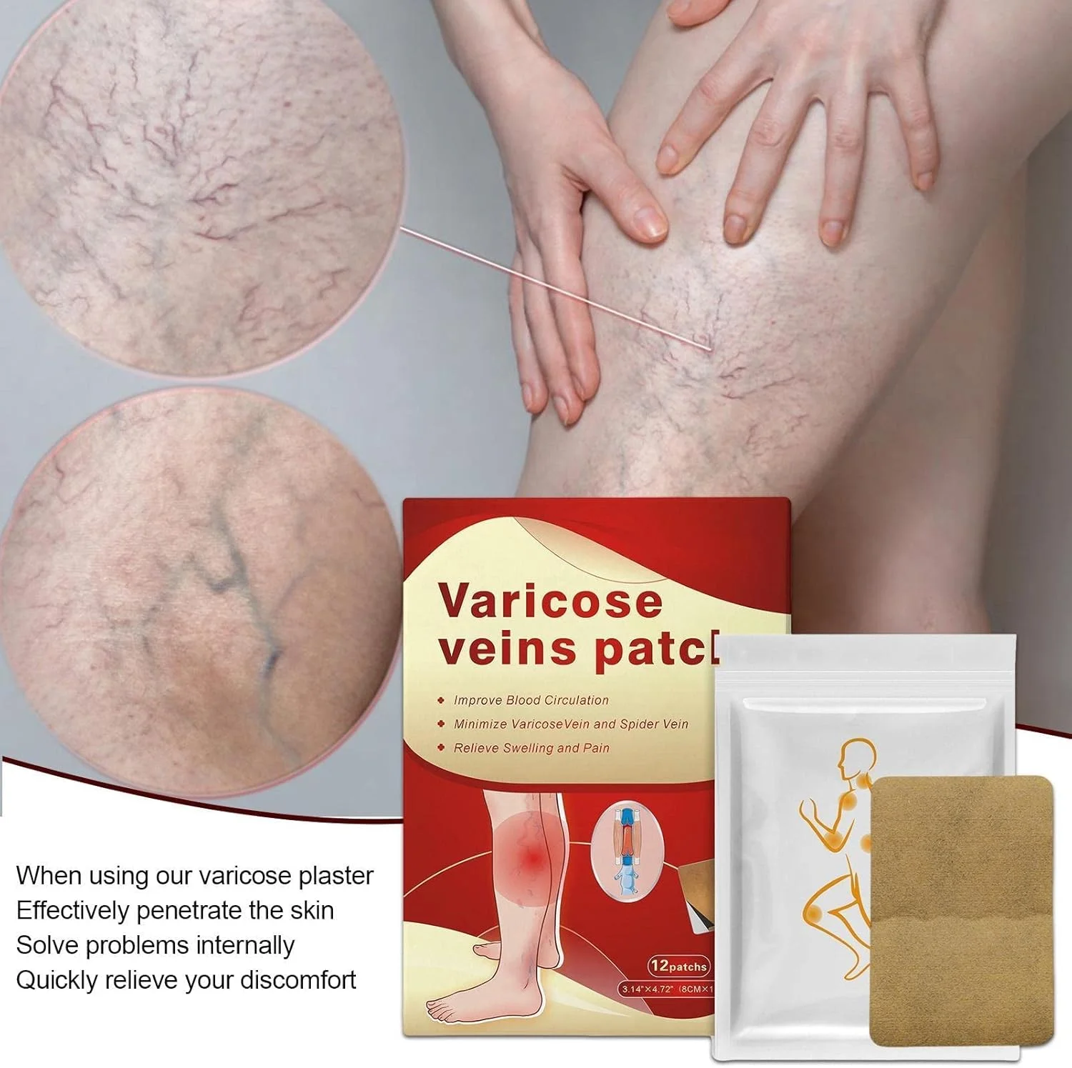 پد رفع رگ های عنکبوتی پا | پماد محو کننده رگ های واریسی - درمان رگ های عنکبوتی، تقویت سلامت مویرگ ها، بهبود گردش خون، کاهش تورم پا