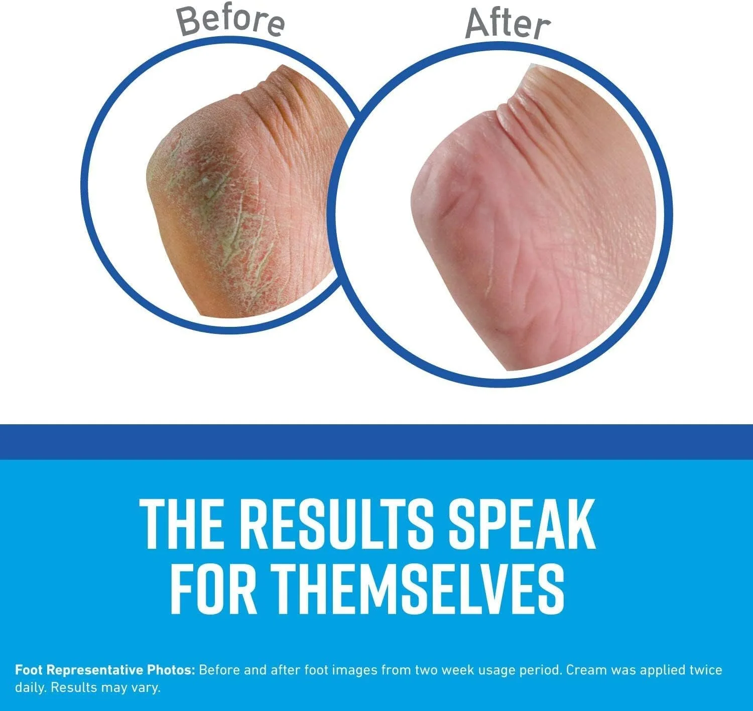 کرم ترمیم کننده پای اوکیفس برای پاهای سالم - 85 گرم