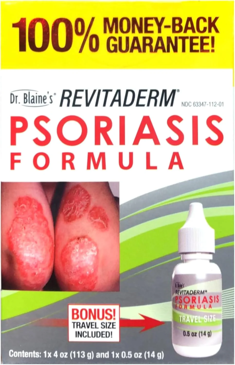 محلول درمان پسوریازیس رویتادرم دکتر بلین، 120 میلی لیتر (بسته 3 عددی)
