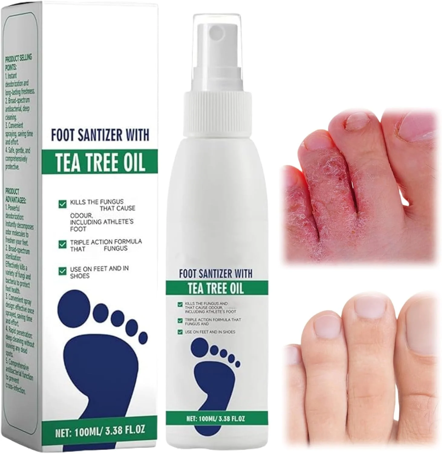 اسپری پای ورزشکاران 100 میلی لیتری، اسپری کفش پای ورزشکاران برای پاهای عرق کرده، اسپری تسکین دهنده قارچ پا، از بین برنده بوی پا، اسپری خوشبو کننده و ضدعفونی کننده پا مناسب برای همه، اسپری لایه بردار فوری پا