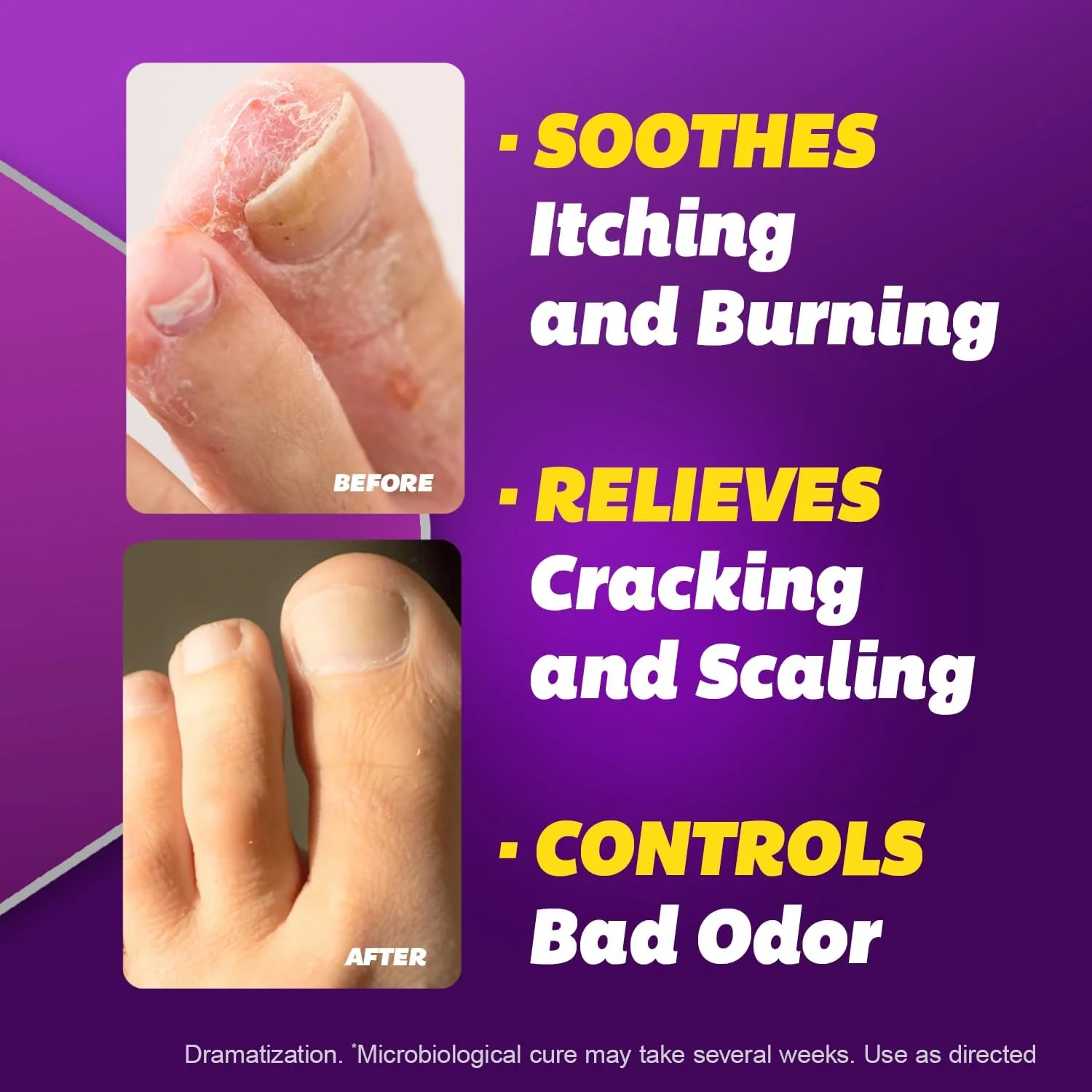 کرم ضد قارچ سیلکا، 28 گرم (بسته 4 عددی)