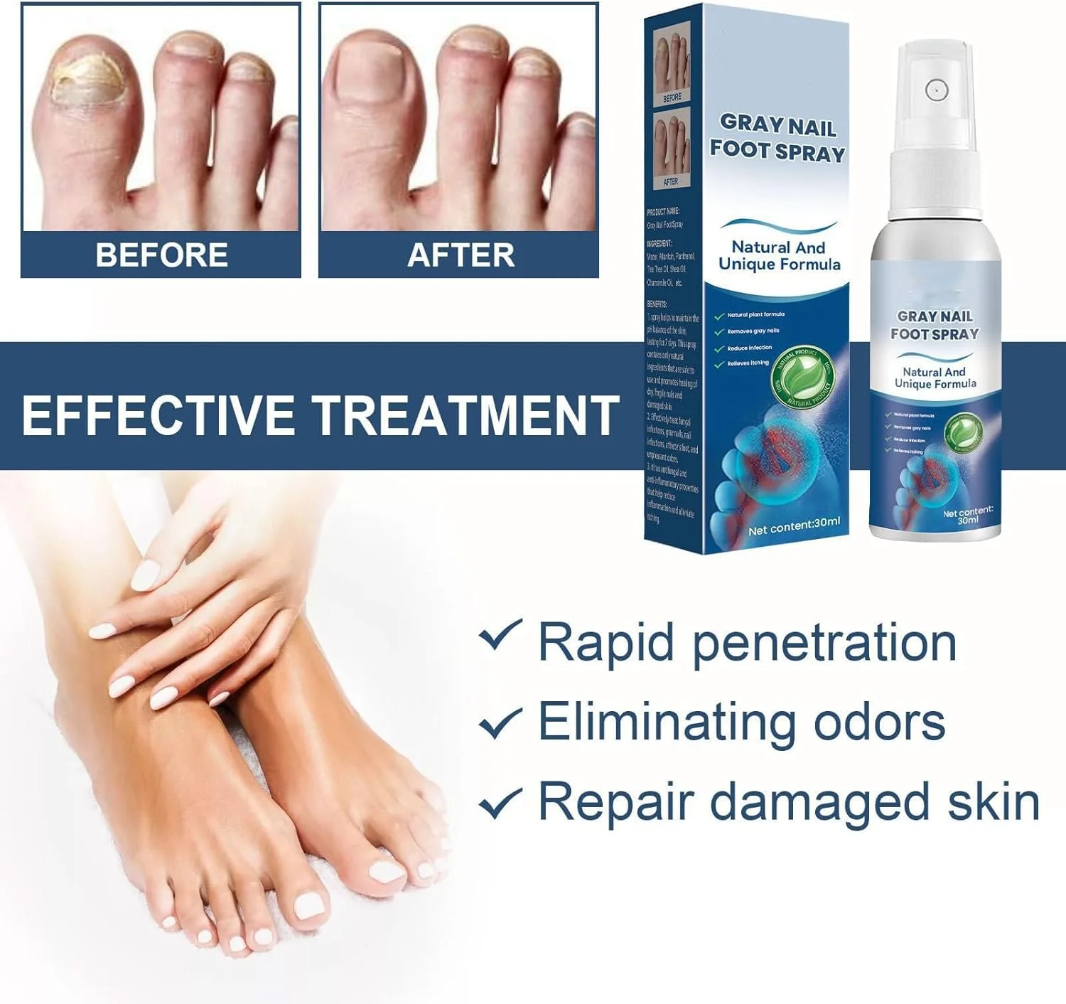 اسپری پای ورزشکاران Rhomba، حاوی مواد طبیعی، درمان پای ورزشکاران، تسکین سریع و موثر التهاب و خارش قارچ پا