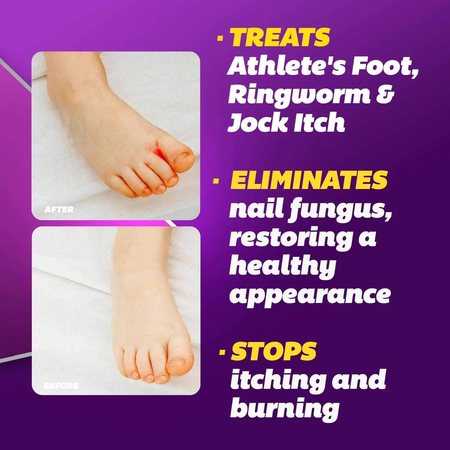 مجموعه مایع و کرم ضد قارچ سیلکا با قدرت حداکثری - تسکین قدرتمند برای عفونت های قارچی ناخن پا، پای ورزشکاران و قارچ پوستی، تسکین خارش و سوزش