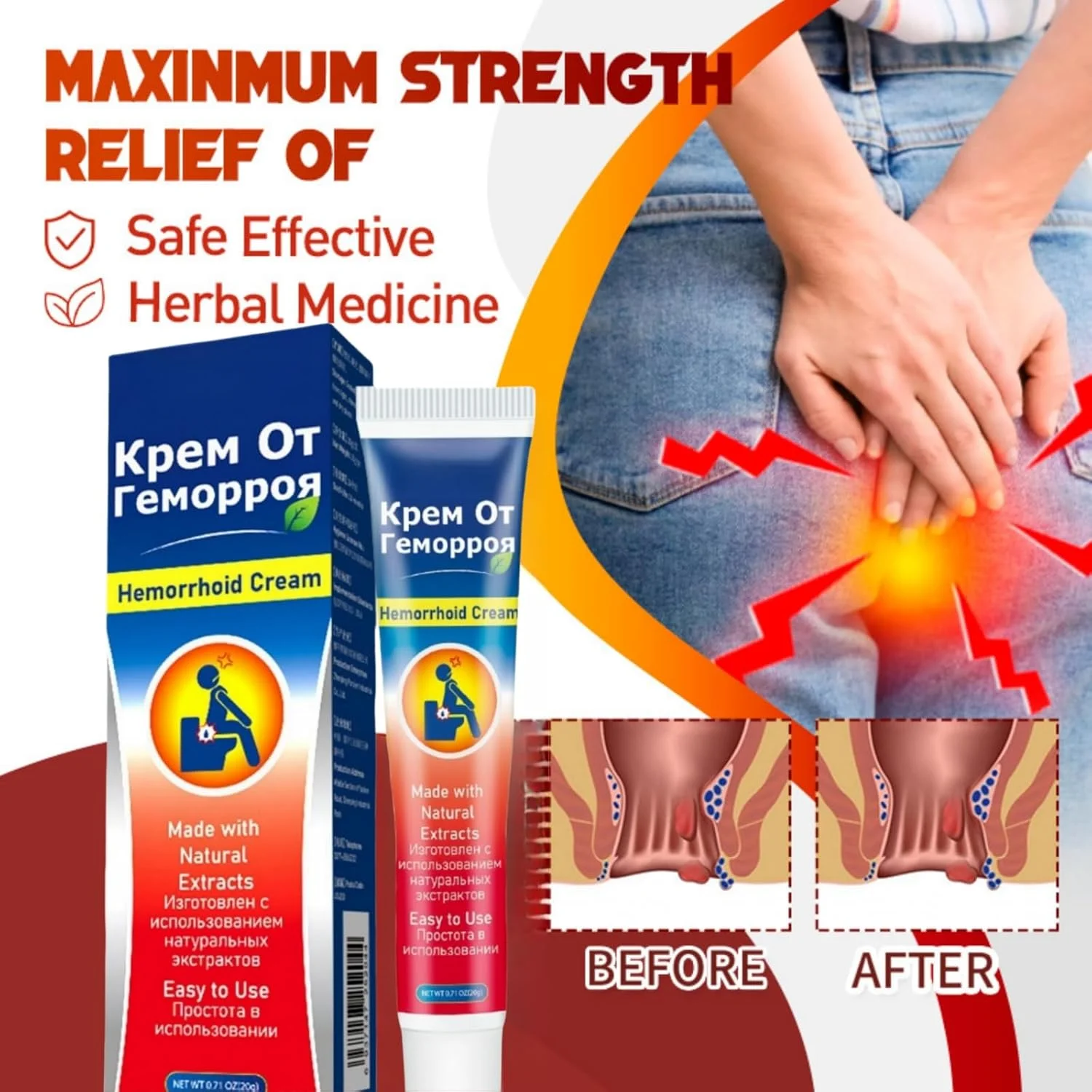 کرم بواسیر - پماد موثر درمان هموروئید برای شقاق داخلی و خارجی، تسکین تورم، خارش، درد و ناراحتی، ژل تسکین دهنده و التیام بخش برای مراقبت از مقعد 20 گرم