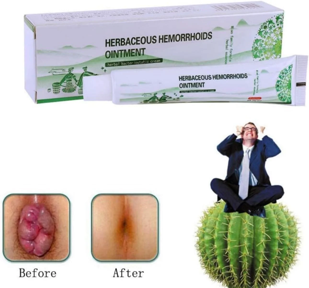 پماد گیاهی 20 گرمی برای مشکلات مقعدی، کرم پسوریازیس بدن، مراقبت از پوست، ضد التهاب و خنک کننده