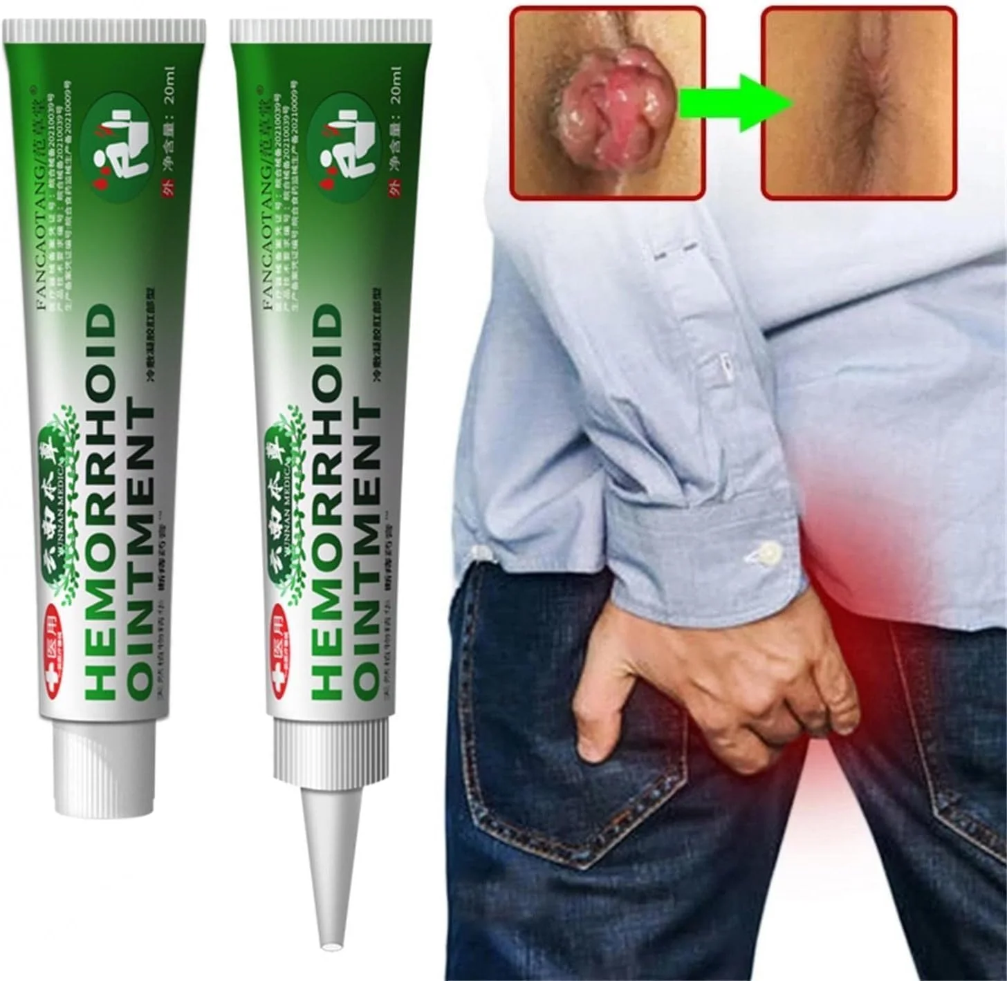 کرم بواسیر گیاهی Rhomba، کرم گیاهی چینی برای مردان و زنان، ژل درمان بواسیر، پماد بواسیر و شقاق، فرمول التیام بواسیر با تسکین سریع