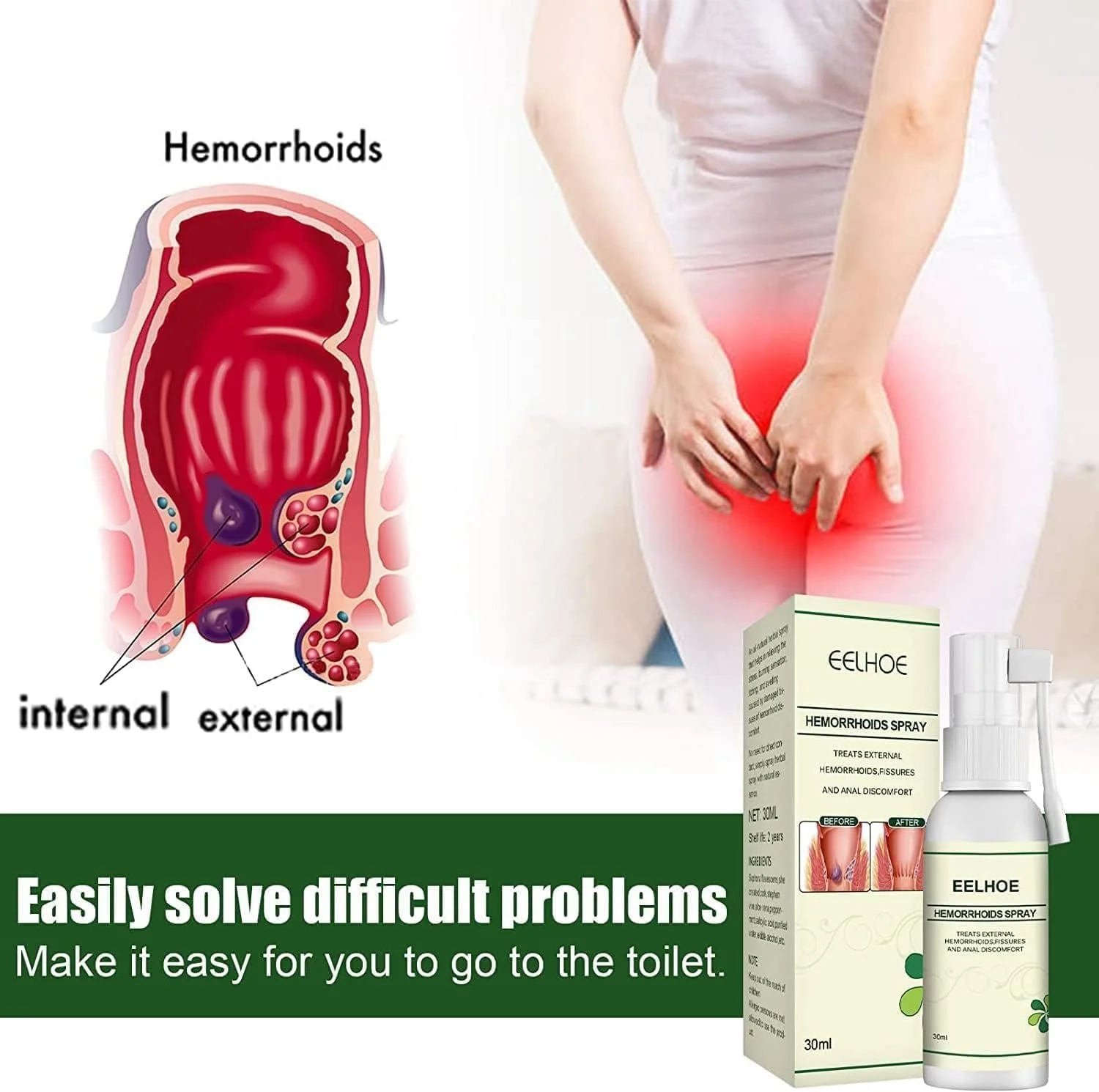 اسپری بواسیر گیاهی Eelhoe، بسته 2 عددی