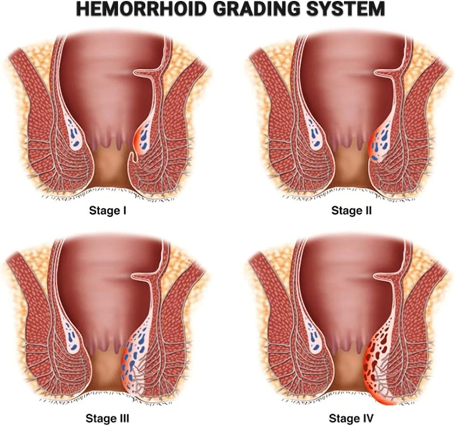 پماد 20 گرمی، تسکین موثر، عصاره های گیاهی، بهبود گردش خون، اثر تسکین دهنده و خنک کننده، کوچک کننده، آبرسان و مرطوب کننده، جذب سریع