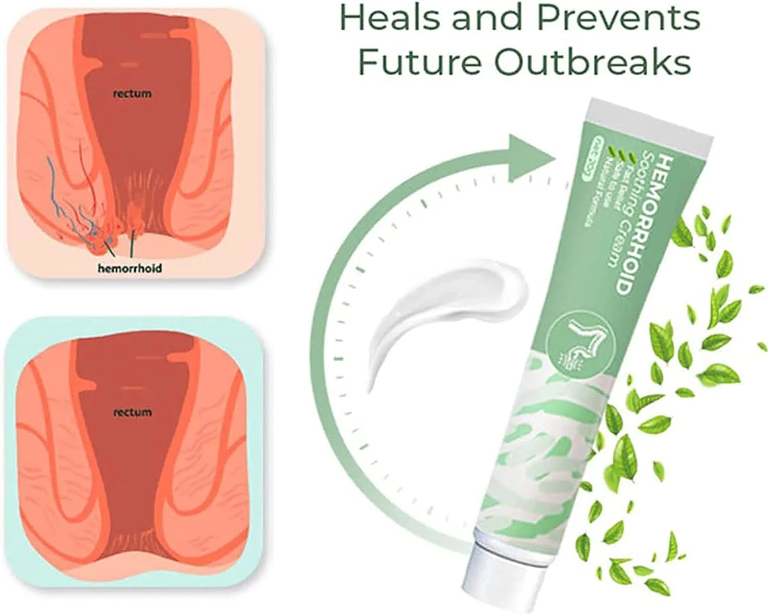 کرم تسکین دهنده بواسیر گیاهی Koltax آلمانی، پماد گیاهی طبیعی بواسیر، کرم بواسیر، کرم تسکین دهنده بواسیر برای تمام سنین (3 عدد)