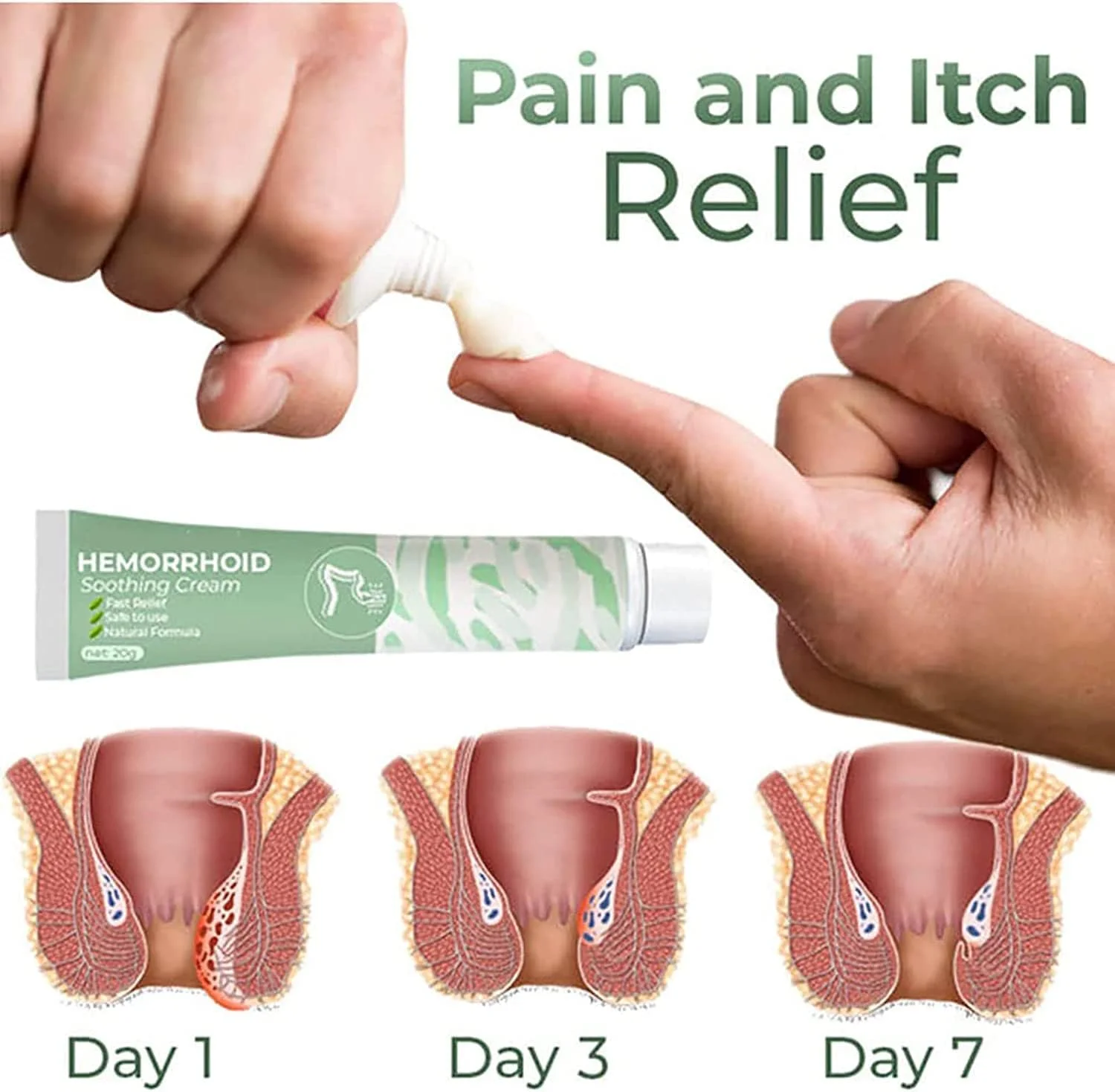 کرم تسکین دهنده بواسیر گیاهی Koltax آلمانی، پماد گیاهی طبیعی بواسیر، کرم بواسیر، کرم تسکین دهنده بواسیر برای تمام سنین (3 عدد)