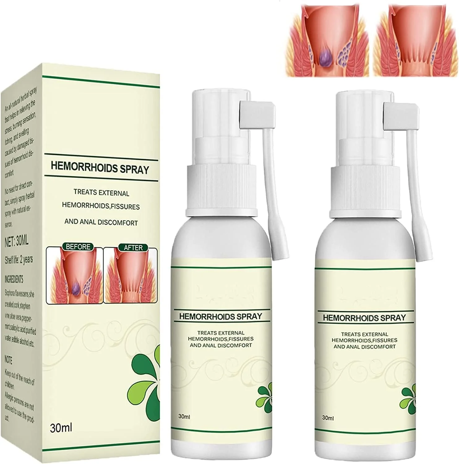 اسپری گیاهی طبیعی کره ای برای تسکین درد و خارش هموروئید، اسپری 30 میلی لیتری هموروئید، اسپری تسکین دهنده خارش هموروئید، فرمول 100% طبیعی برای تسکین سریع درد و خارش (2 عدد)