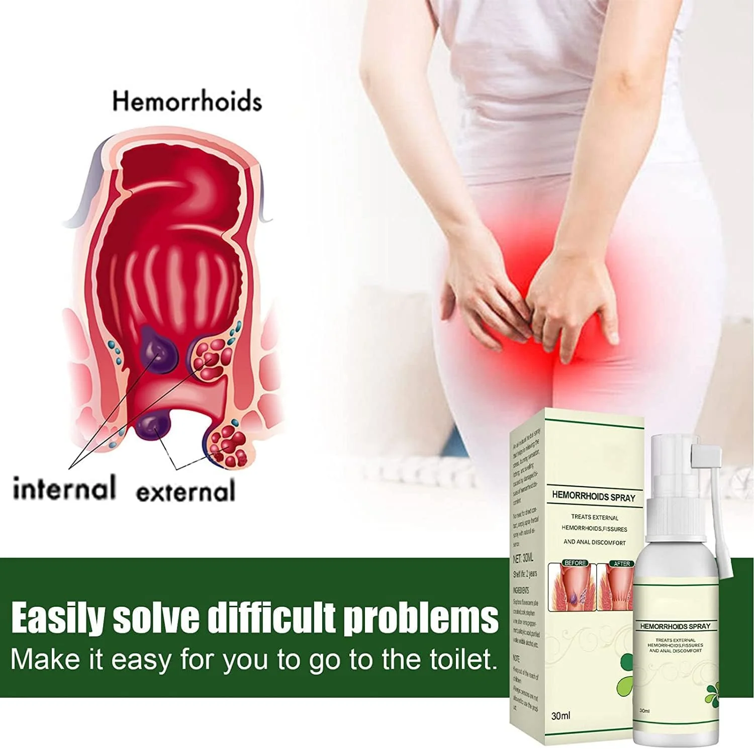 اسپری گیاهی طبیعی کره ای برای تسکین درد و خارش هموروئید، اسپری 30 میلی لیتری هموروئید، اسپری تسکین دهنده خارش هموروئید، فرمول 100% طبیعی برای تسکین سریع درد و خارش (2 عدد)
