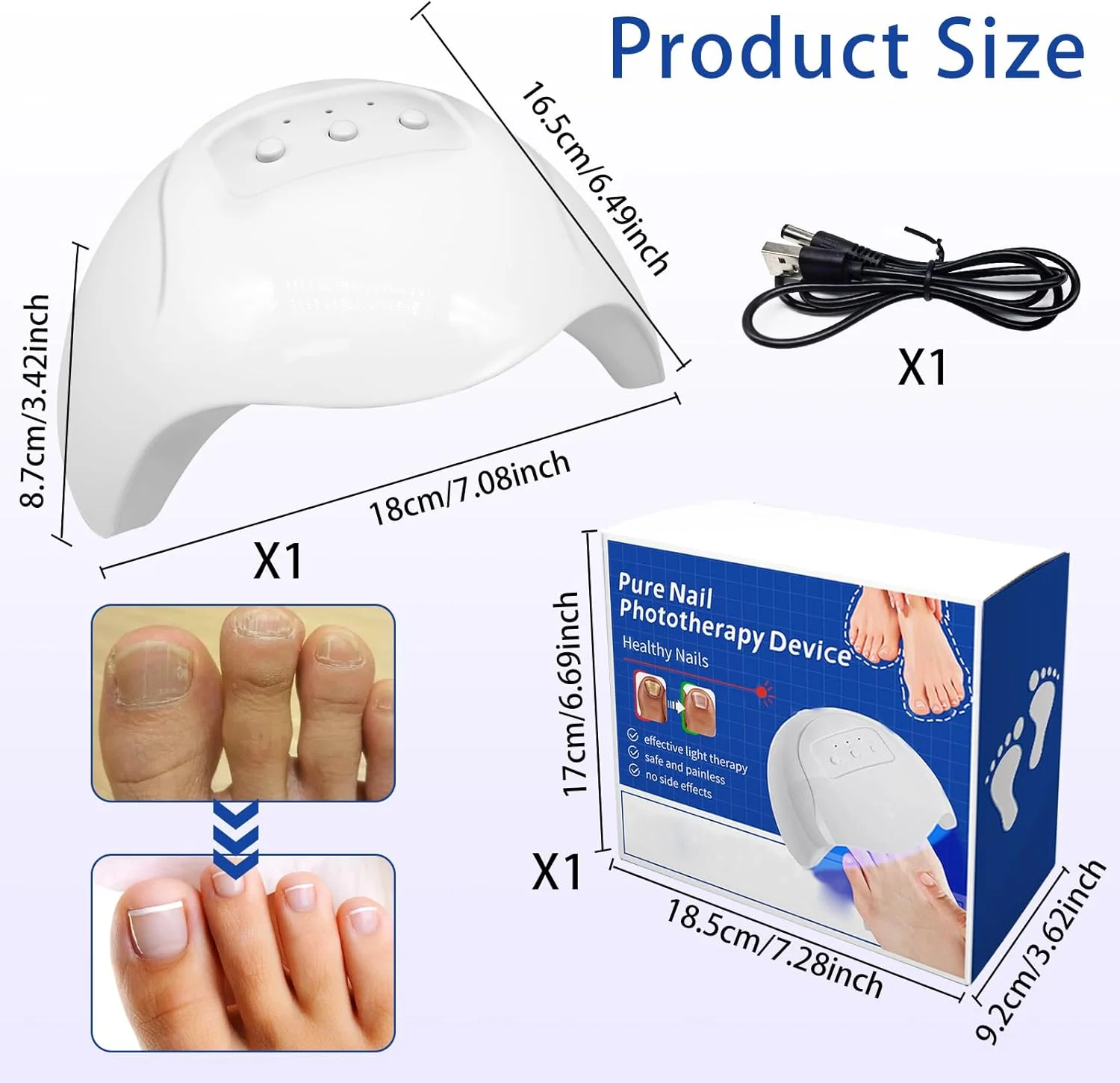 دستگاه لیزر نور درمانی قارچ ناخن برای مقابله با قارچ ناخن، لیزر قارچ ناخن، دستگاه حذف قارچ ناخن با لیزر، دستگاه نور درمانی، دستگاه لیزر قارچ ناخن، درمان سریع و فشرده قارچ ناخن با لیزر